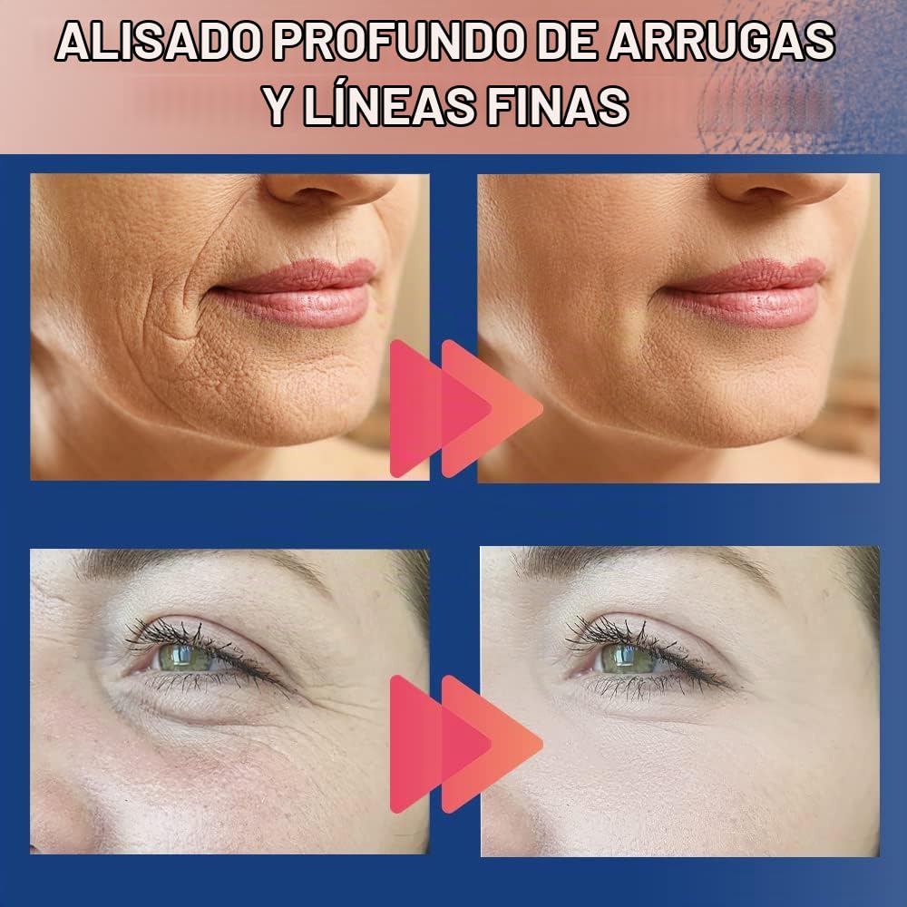 PARCHE FACIAL ANTIARRUGAS AKISSOS 2 ROLLOS 2.5CM X 5M PARA ROSTRO Y CUELLO - 5