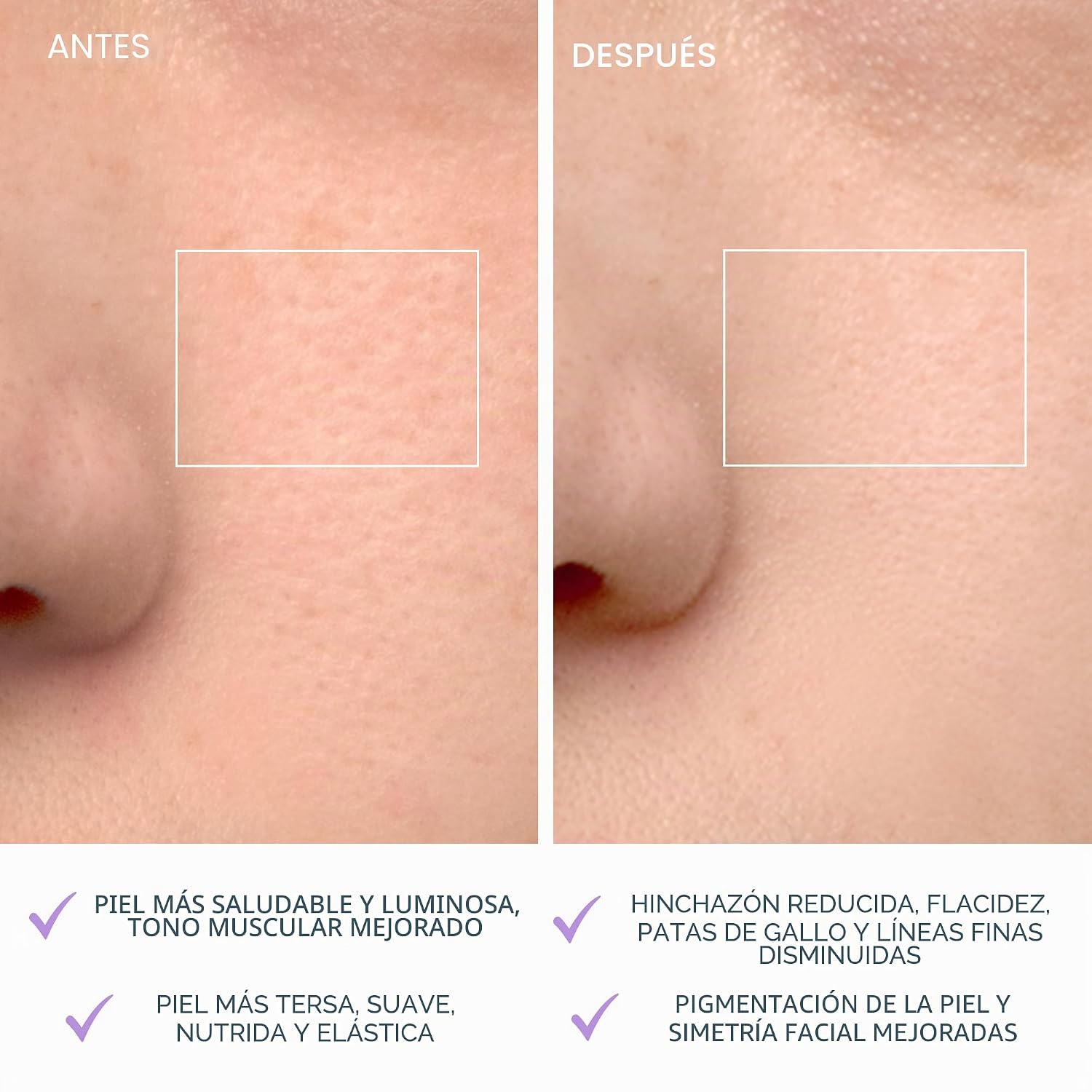 CEPILLO FACIAL FOREO LUNA 4 MASAJEADOR REAFIRMANTE - 5