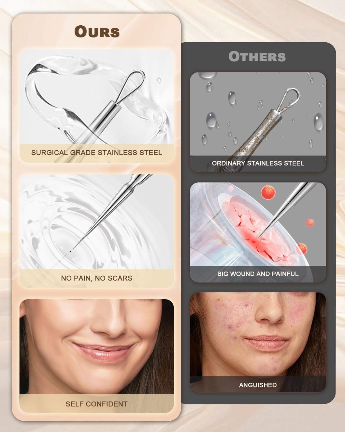 KIT REMOVEDOR DE ESPINILLAS Y MILIA SGNEKOO CON AGUJA DOBLE Y PINZAS DE ACERO INOXIDABLE - 5