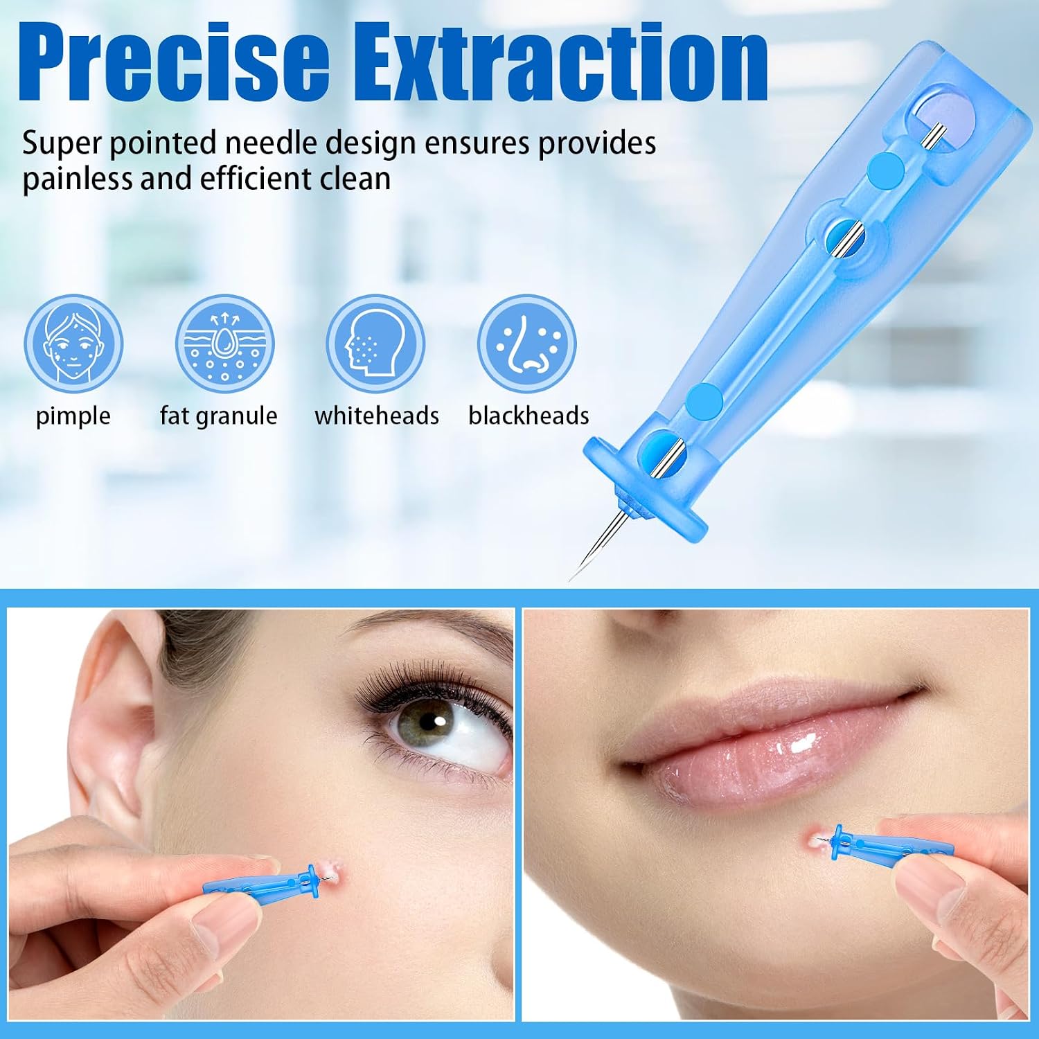 LANCETAS PARA EXTRACCIÓN FACIAL HFYHWT 100 UNIDADES DESECHABLES - 3