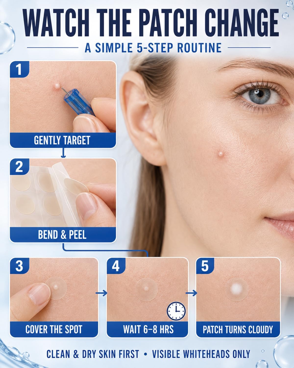KIT DE CUIDADO FACIAL DTTIYXI CON 50 AGUJAS DESECHABLES Y 72 PARCHES HIDROCOLOIDES - 3