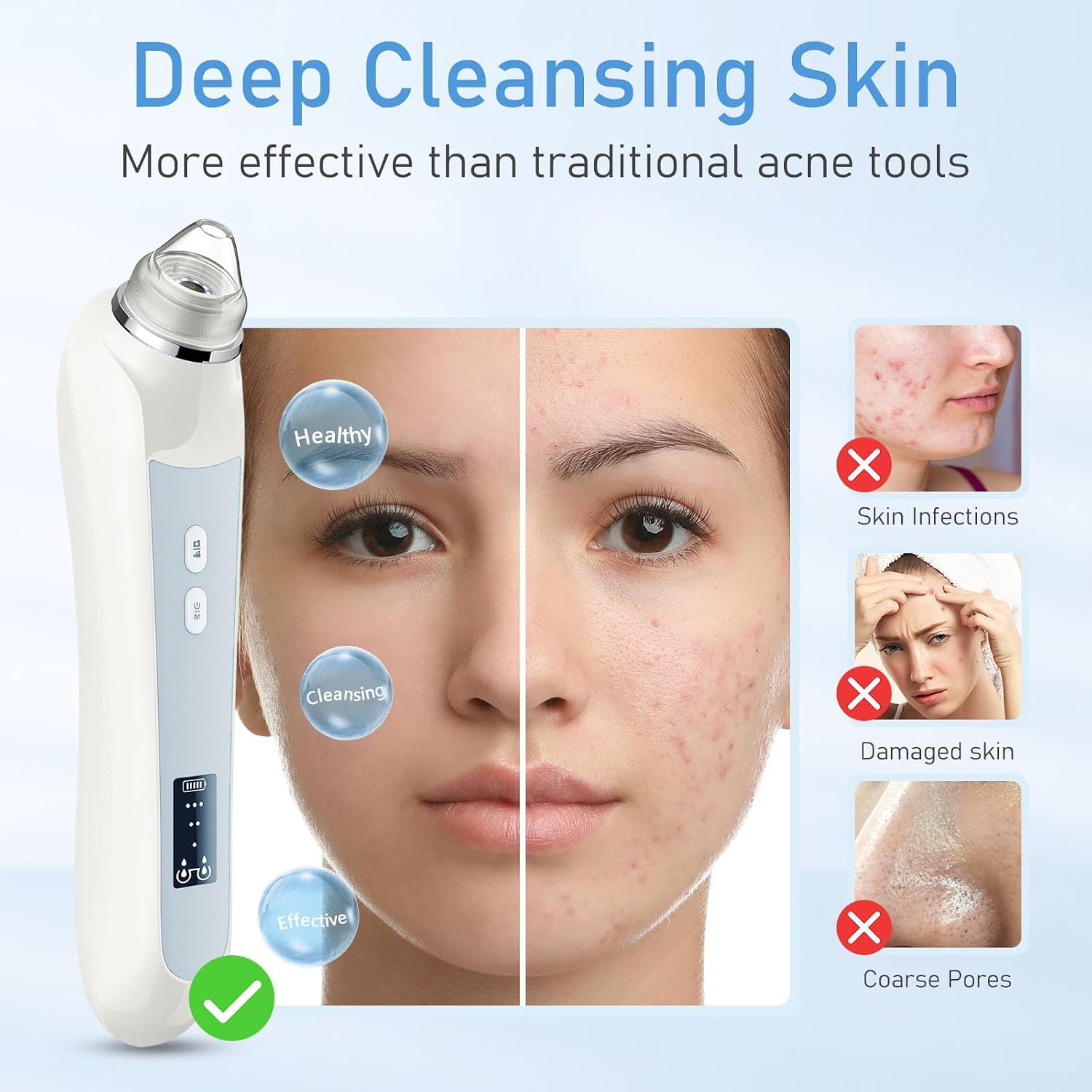 REMOVEDOR DE PUNTOS NEGROS FACIAL OTTLEBA CON CÁMARA 1080P Y 6 CABEZALES BLANCO - 4