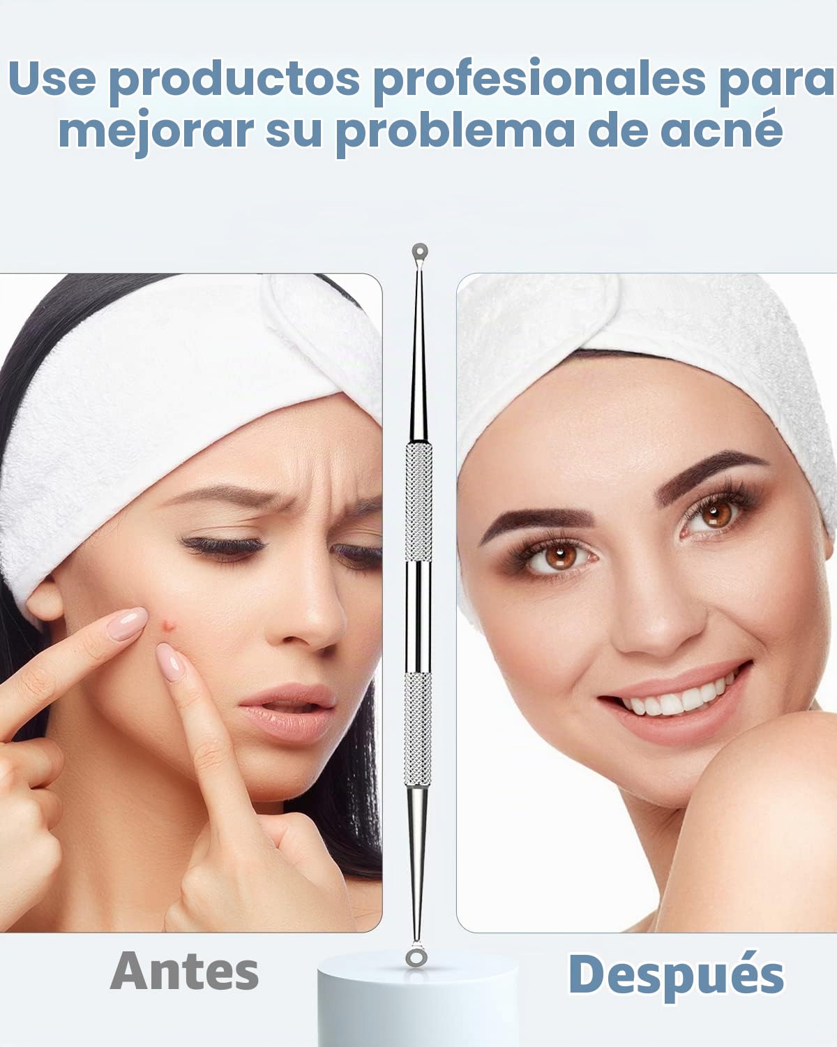 EXTRACTOR DE PUNTOS NEGROS TAYTHI KIT 5 PIEZAS ACERO INOXIDABLE NEGRO - 2