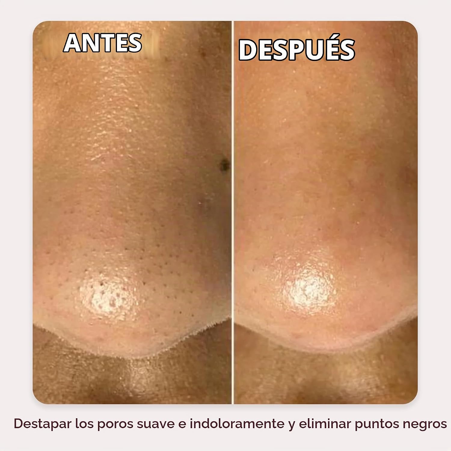 DISPOSITIVO PARA CUIDADO FACIAL DERMAFLASH DERMAPORE+ ULTRASÓNICO 2 EN 1 BLUSH - 5