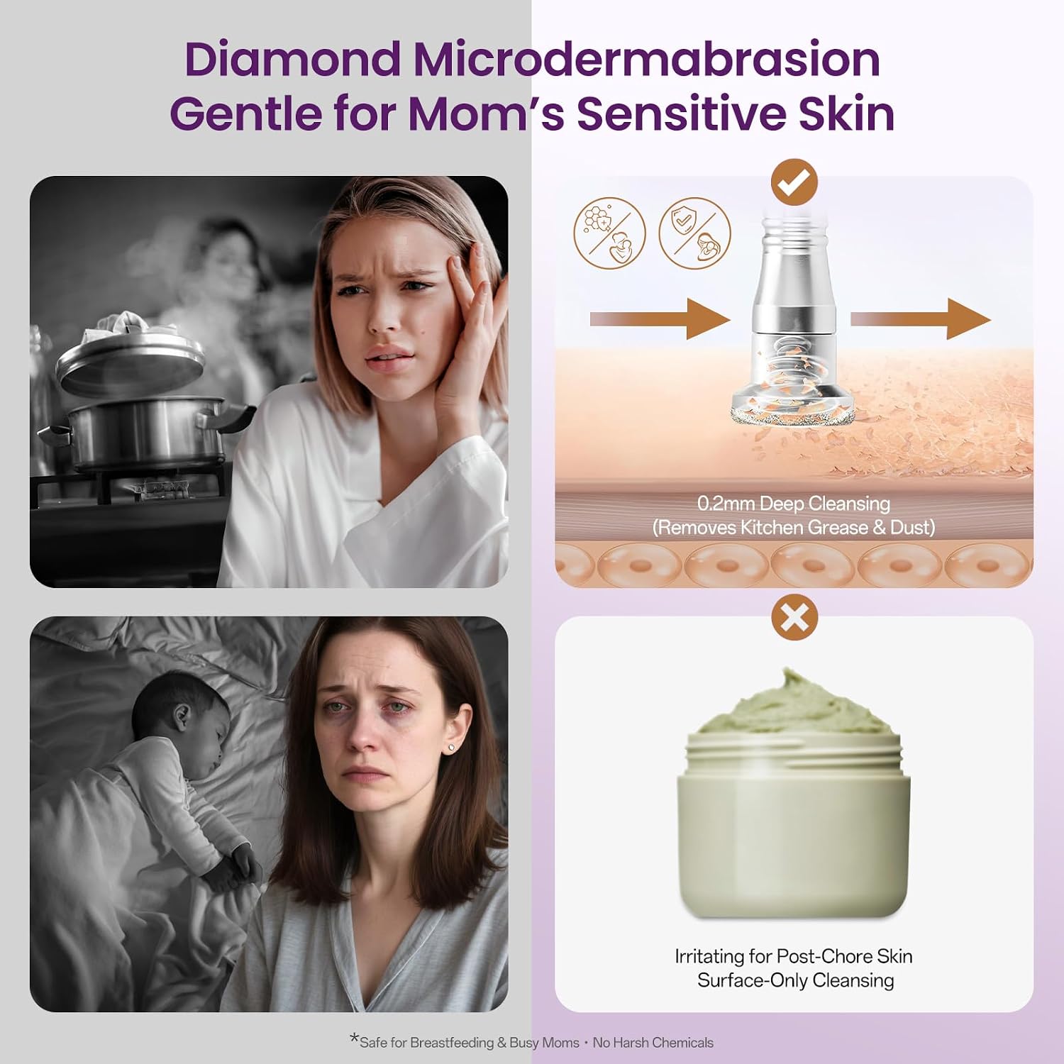 MÁQUINA DE MICRODERMOABRASIÓN UNOISETION DIAMOND 105U BLANCO PURO - 2