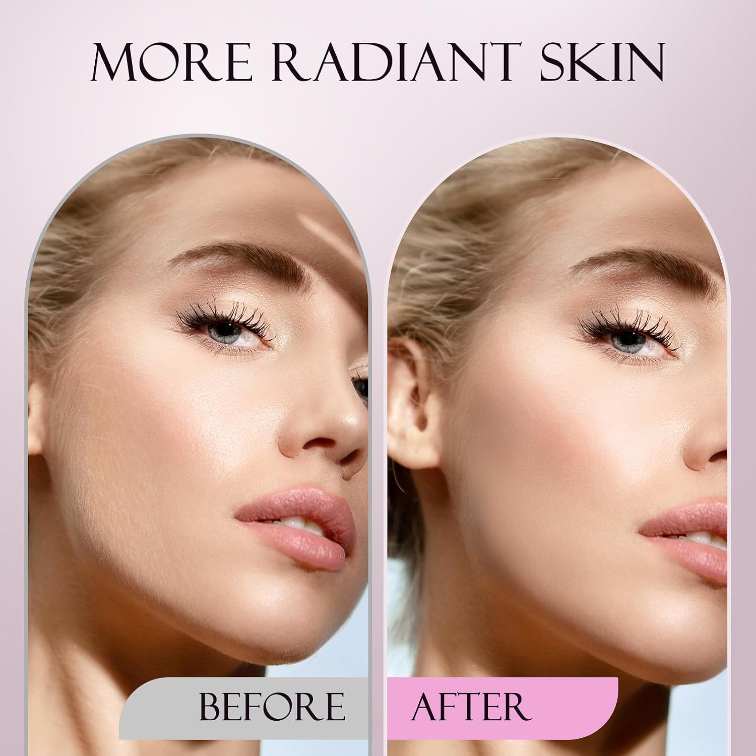 RASURADORA DERMAPLANE SONIC CEVEK U DERMAPRO+ BLANCA - 4