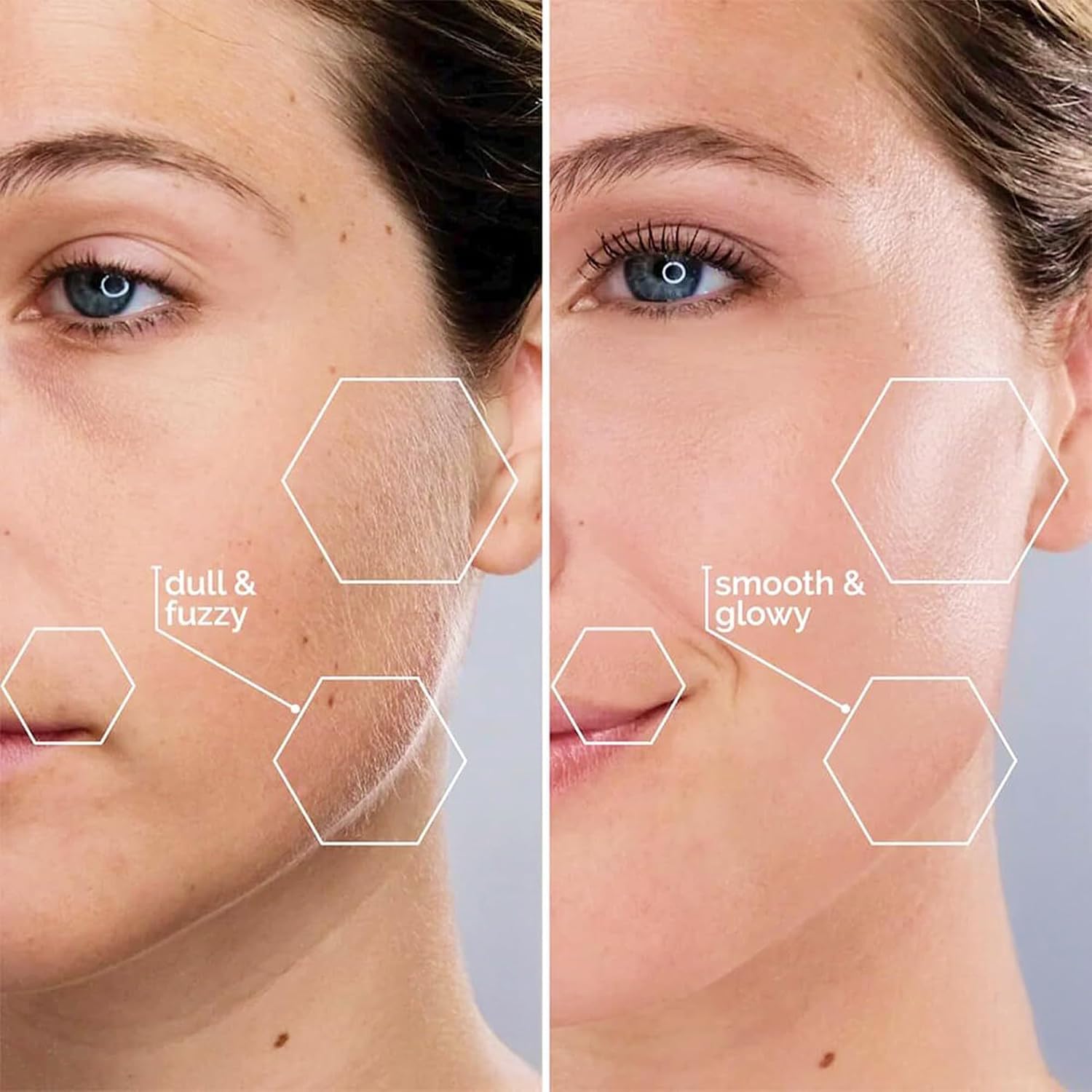 RASURADORA DERMAPLANE MICHAEL TODD SONICSMOOTH PARA ROSTRO MUJER - 4