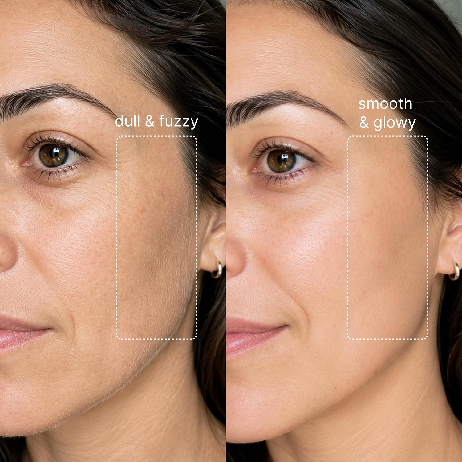 RASURADORA DERMAPLANE MICHAEL TODD SONICSMOOTH PARA ROSTRO MUJER - 5