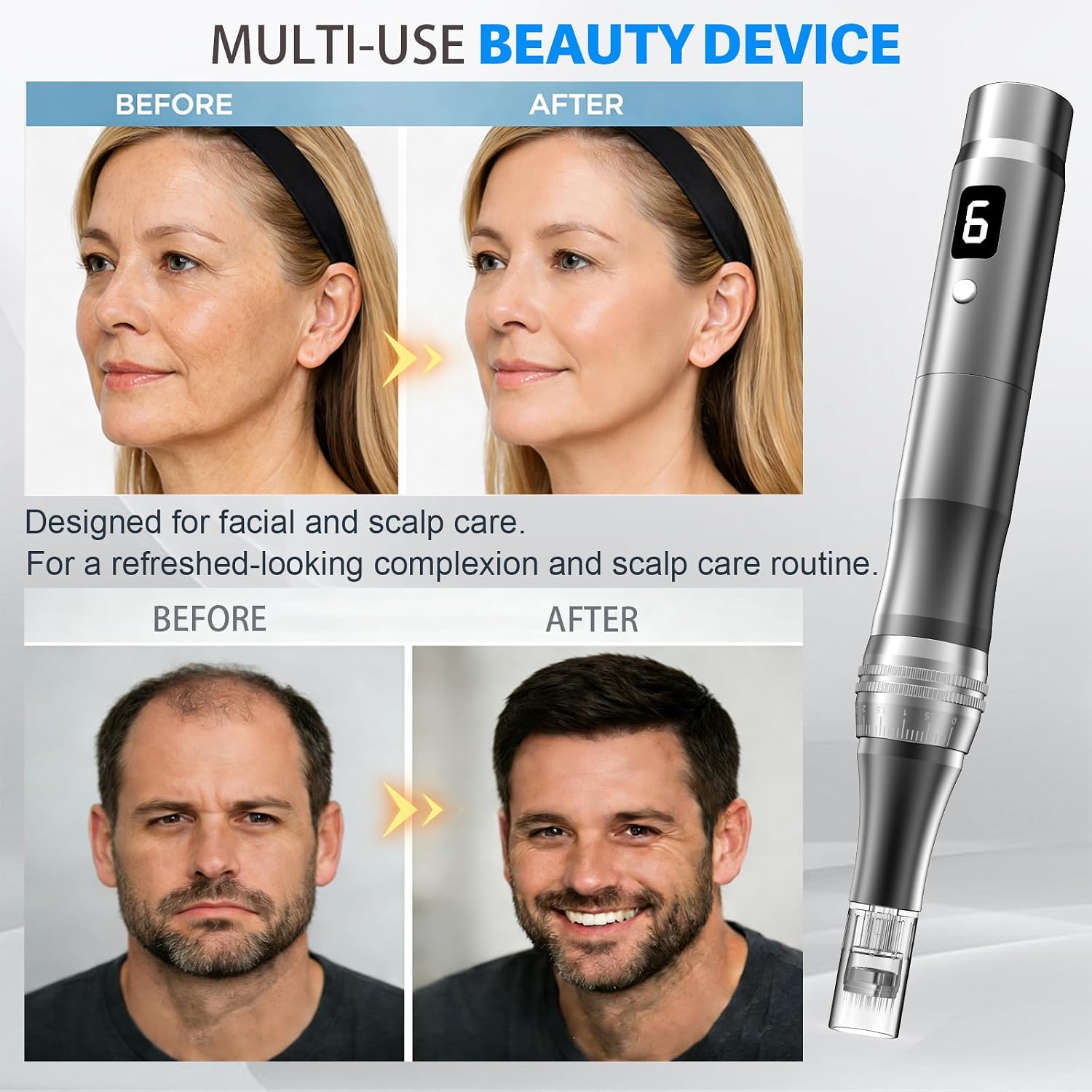 MICRONEEDLING PEN ZUANYIE 0.25MM GRIS - 4
