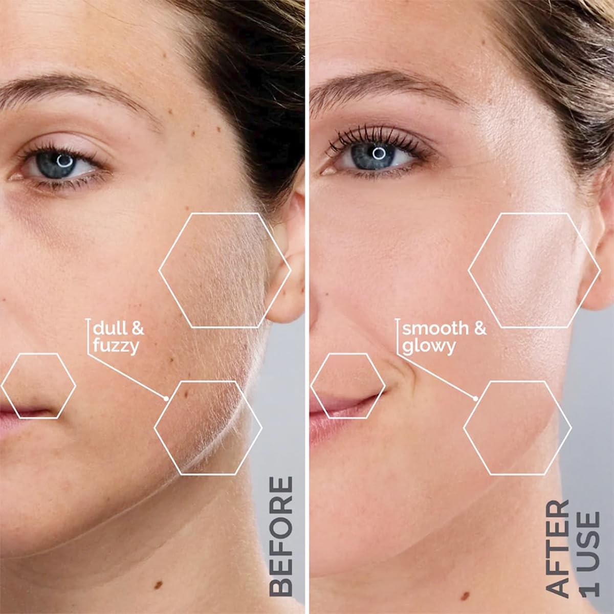 SISTEMA DE DERMAPLANING Y RECORTADOR DE CEJAS MICHAEL TODD SONICSMOOTH PRO+ - 5