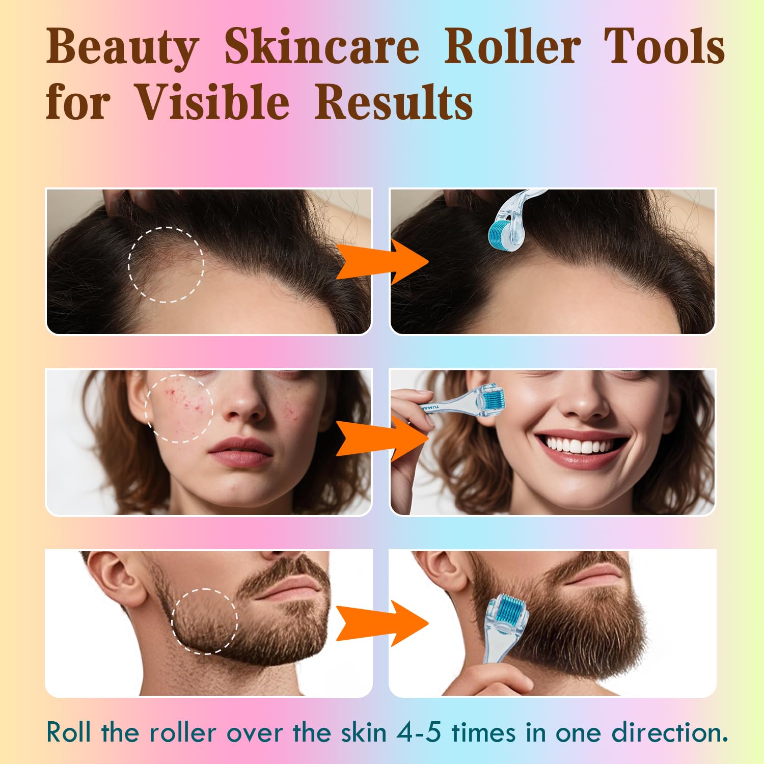 DERMA ROLLER TUMAKOU MICRONEEDLING PARA ROSTRO, CUERO CABELLUDO Y CABELLO - 5