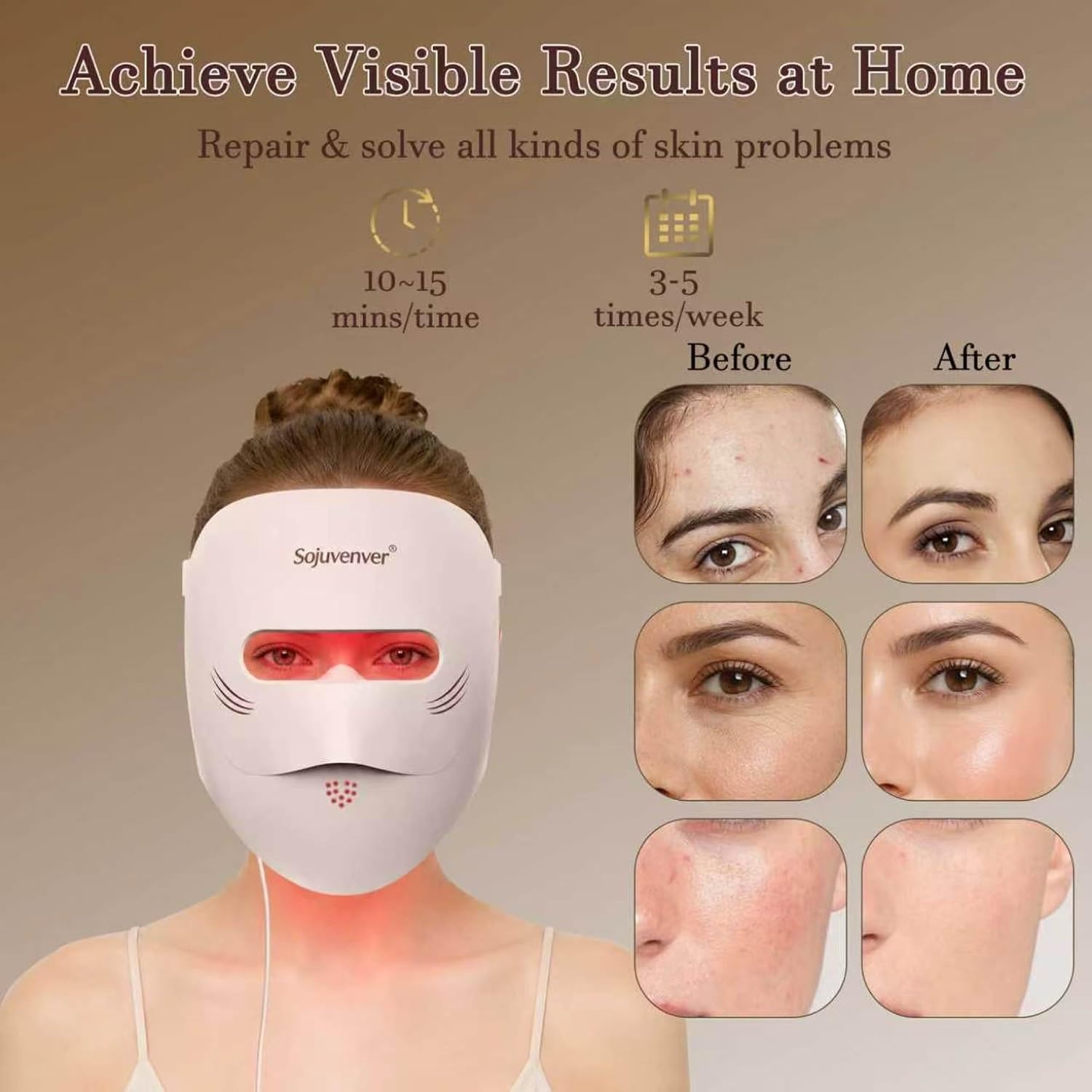 MASCARILLA FACIAL SOJUVENVER 9D TERAPIA DE LUZ ROJA 328 LEDS ANTIEDAD - 5