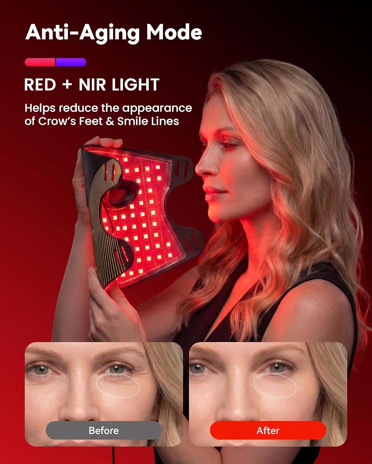 TERAPIA DE LUZ AZUL PARA ACNÉ MICEYLIVE FDA - 5