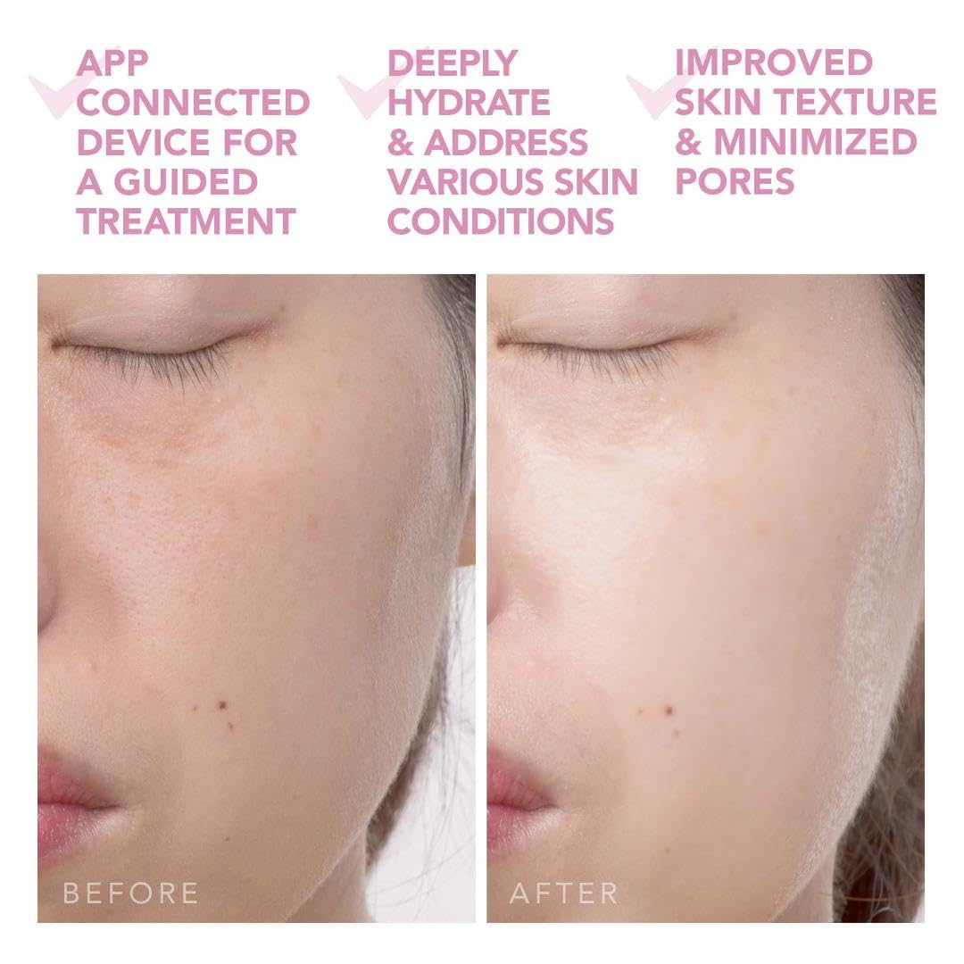 MASCARILLA FACIAL FOREO UFO 2 LED PEARL PINK - 5