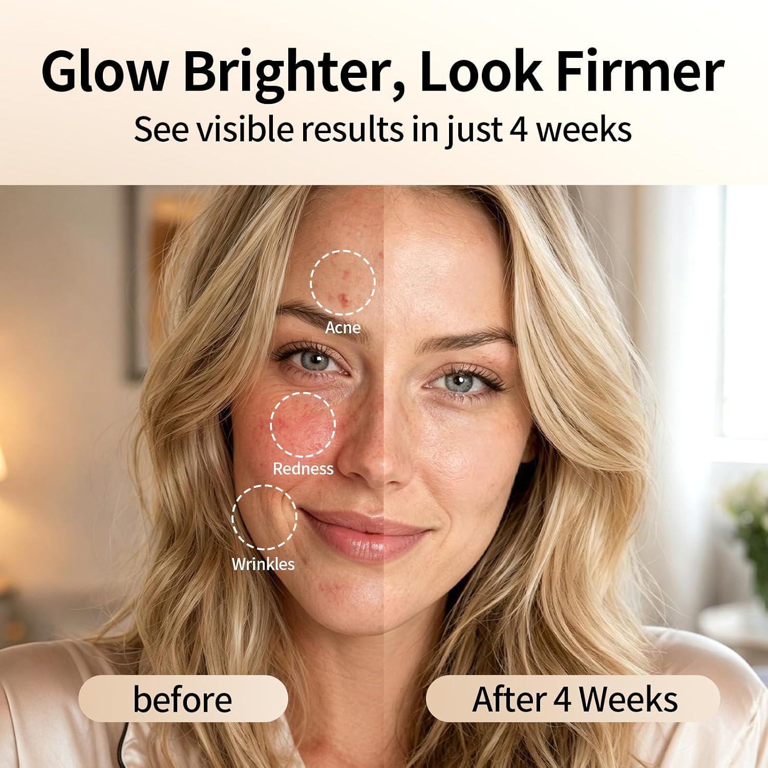 MÁSCARA DE TERAPIA LÁSER 4D PARA ROSTRO JOVS CON 4 LONGITUDES DE ONDA - 5
