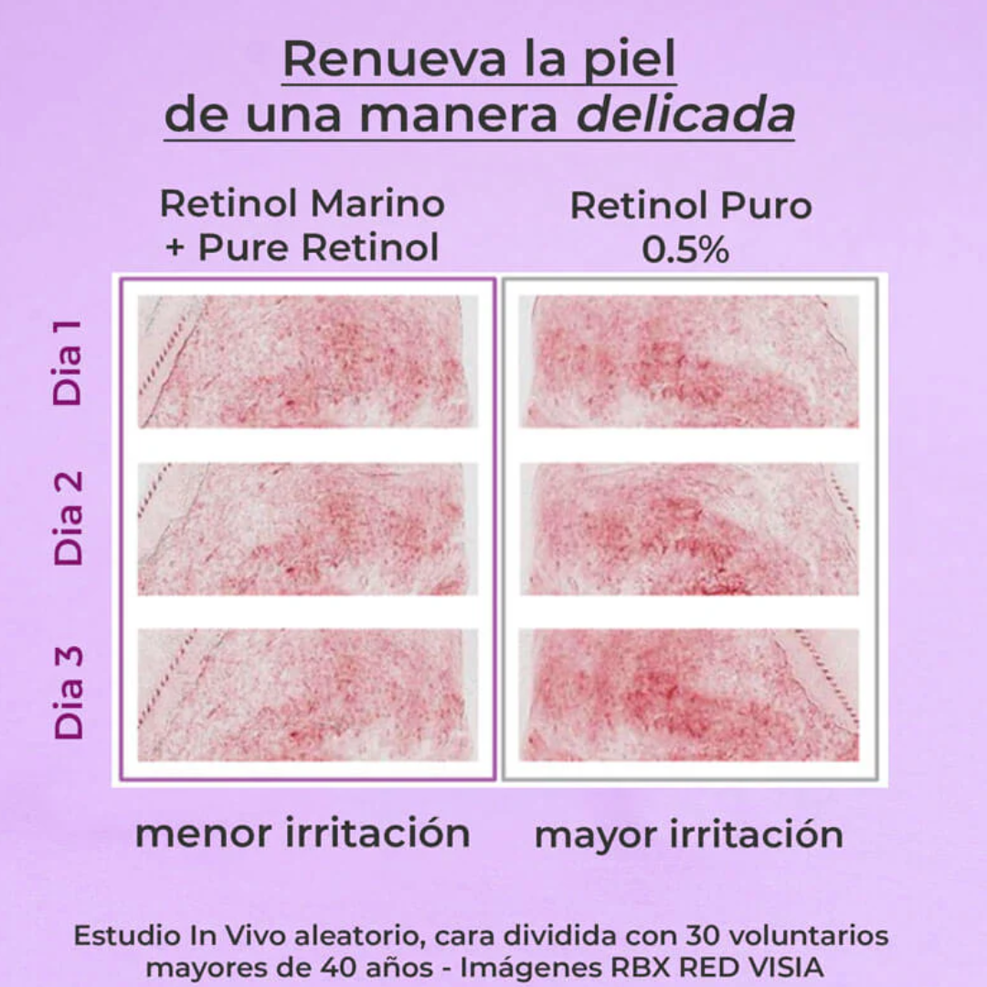 SEGLE PURE RETINOL SÉRUM 30 ML - 5