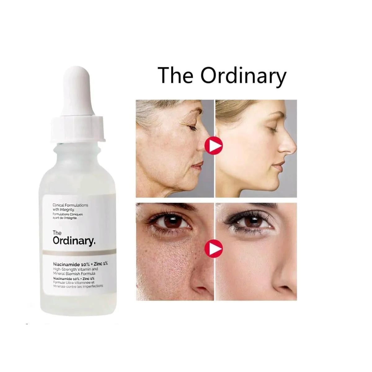 SUERO THE ORDINARY NIACINAMIDE 10% + ZINC 1% (30 ML) - 2