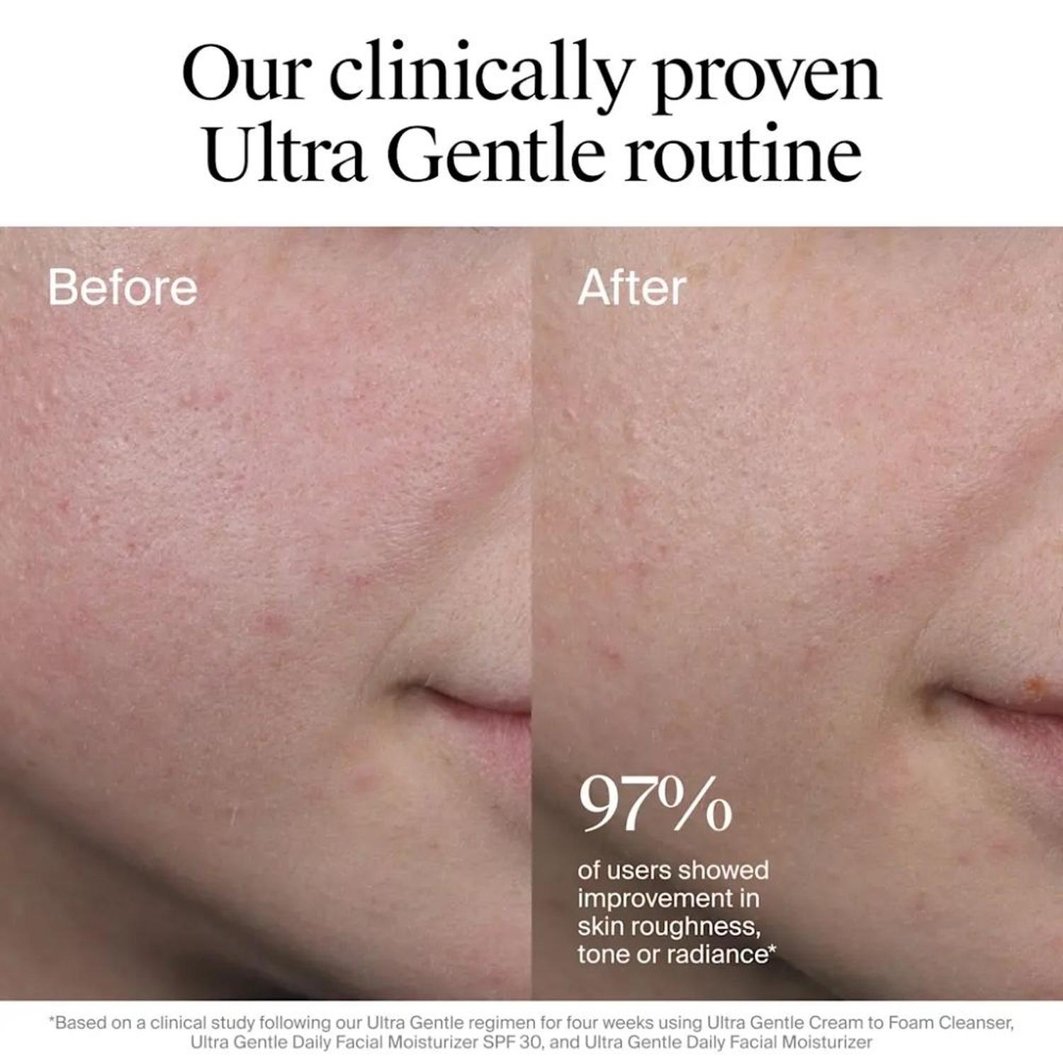 HIDRATANTE FACIAL DIARIO NEUTROGENA CON FPS 30 - 100 ML - 6