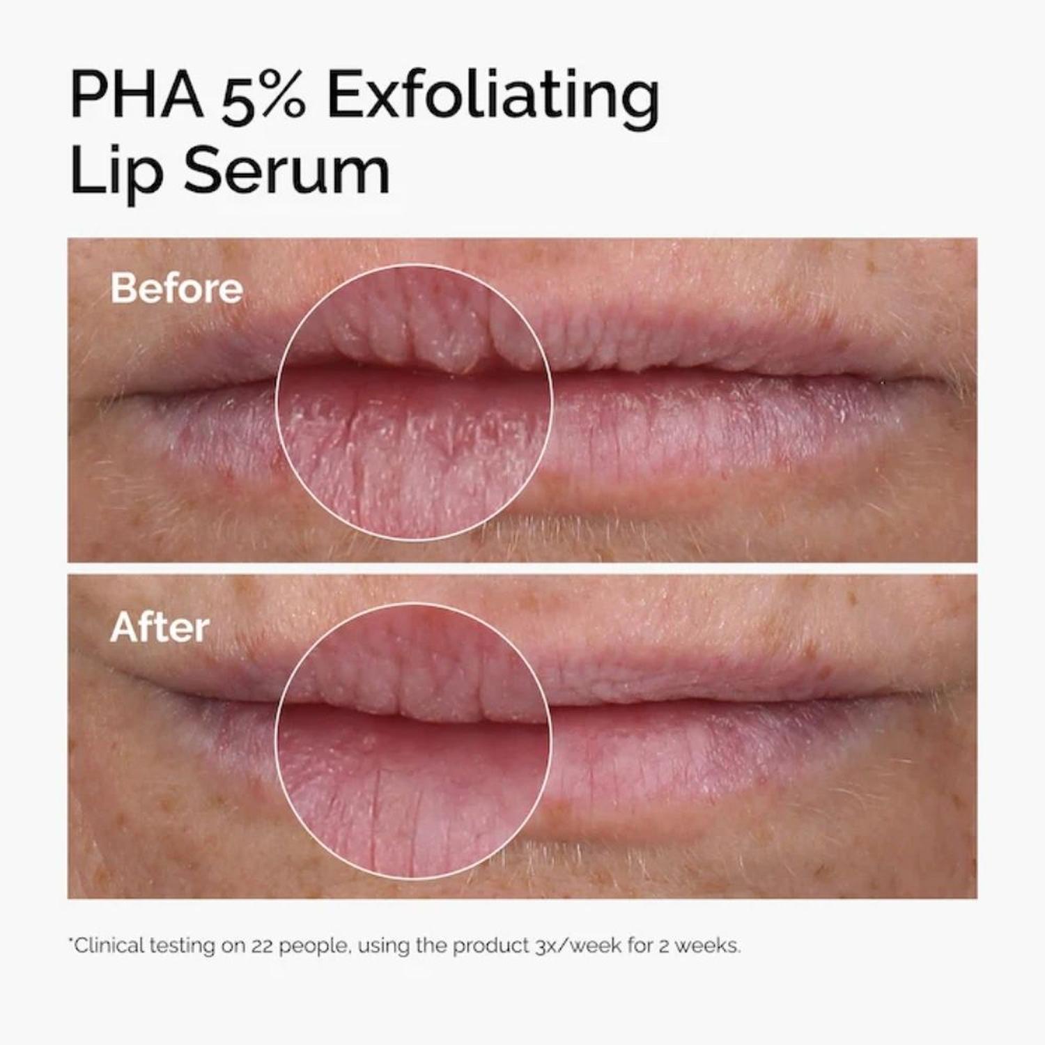 SUERO LABIAL EXFOLIANTE THE ORDIANRY PHA 5% - 3