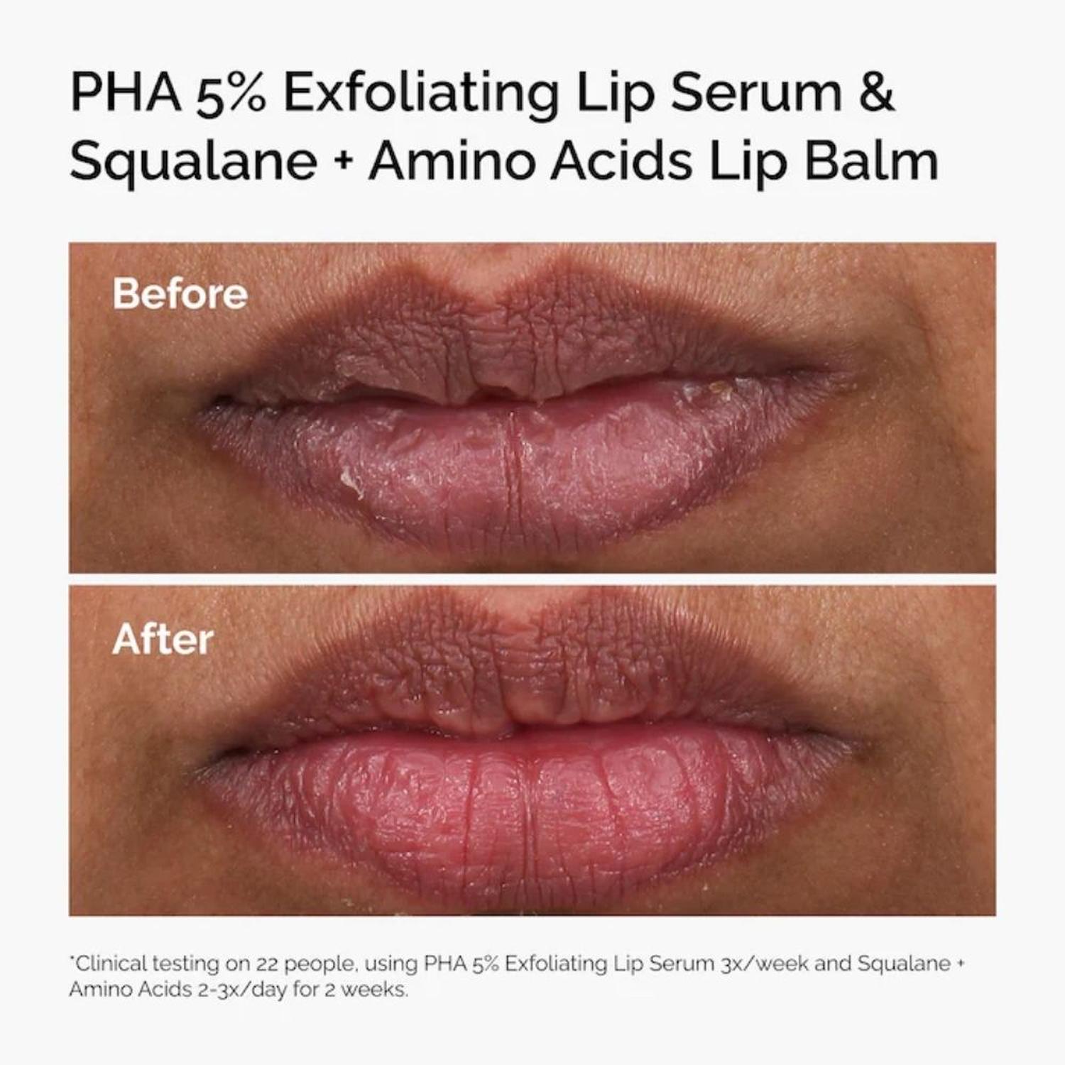 SUERO LABIAL EXFOLIANTE THE ORDIANRY PHA 5% - 4