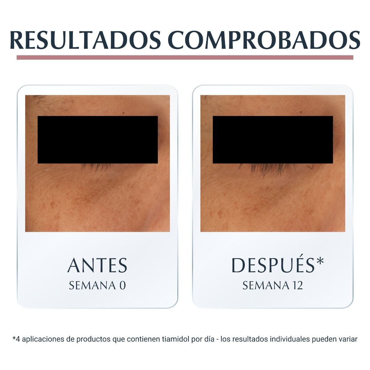 PACK X2 EUCERIN ANTIPIGMENT CONTORNO DE OJOS Y ANTIOJERAS 15ML - 5