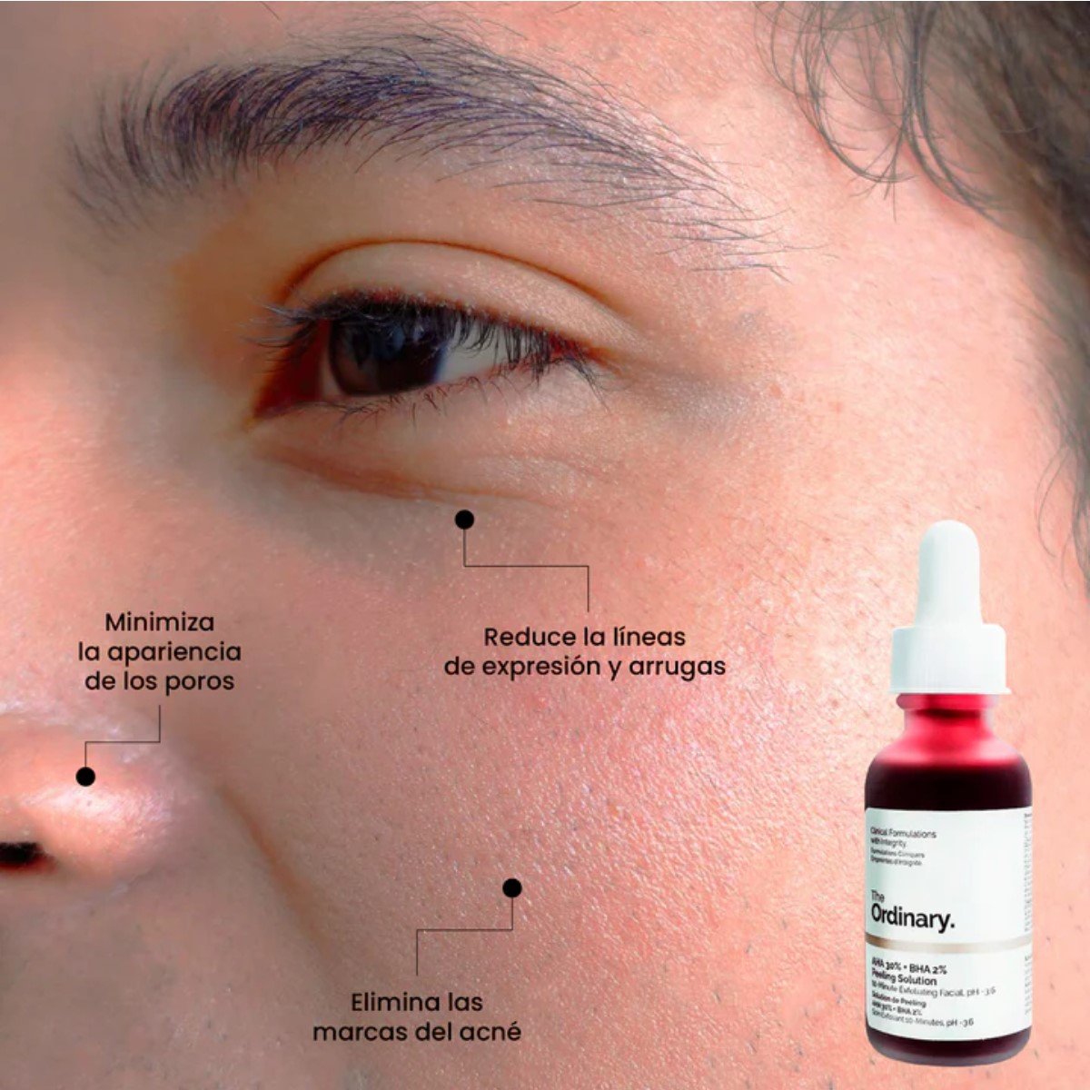 THE ORDINARY AHA 30% + BHA 2% PEELING SOLUTION 30 ML - 2