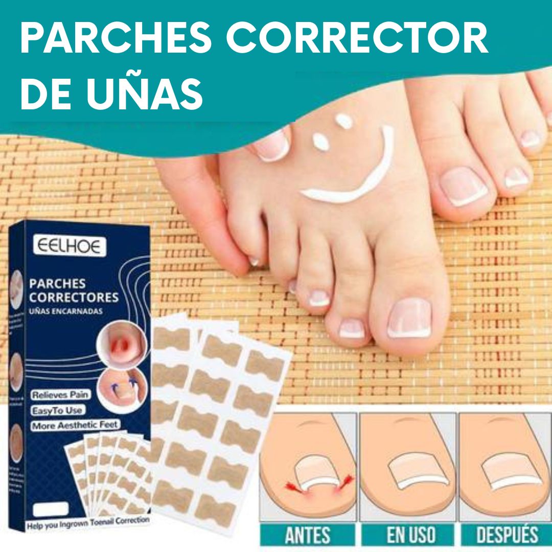 EASYPATCH™ PARCHES CORRECTORES DE UÑAS - UÑAS BONITAS Y SANAS (PACK X50 UND) - 1