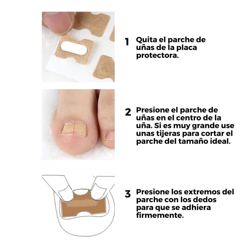 EASYPATCH™ PARCHES CORRECTORES DE UÑAS - UÑAS BONITAS Y SANAS (PACK X50 UND) - 2