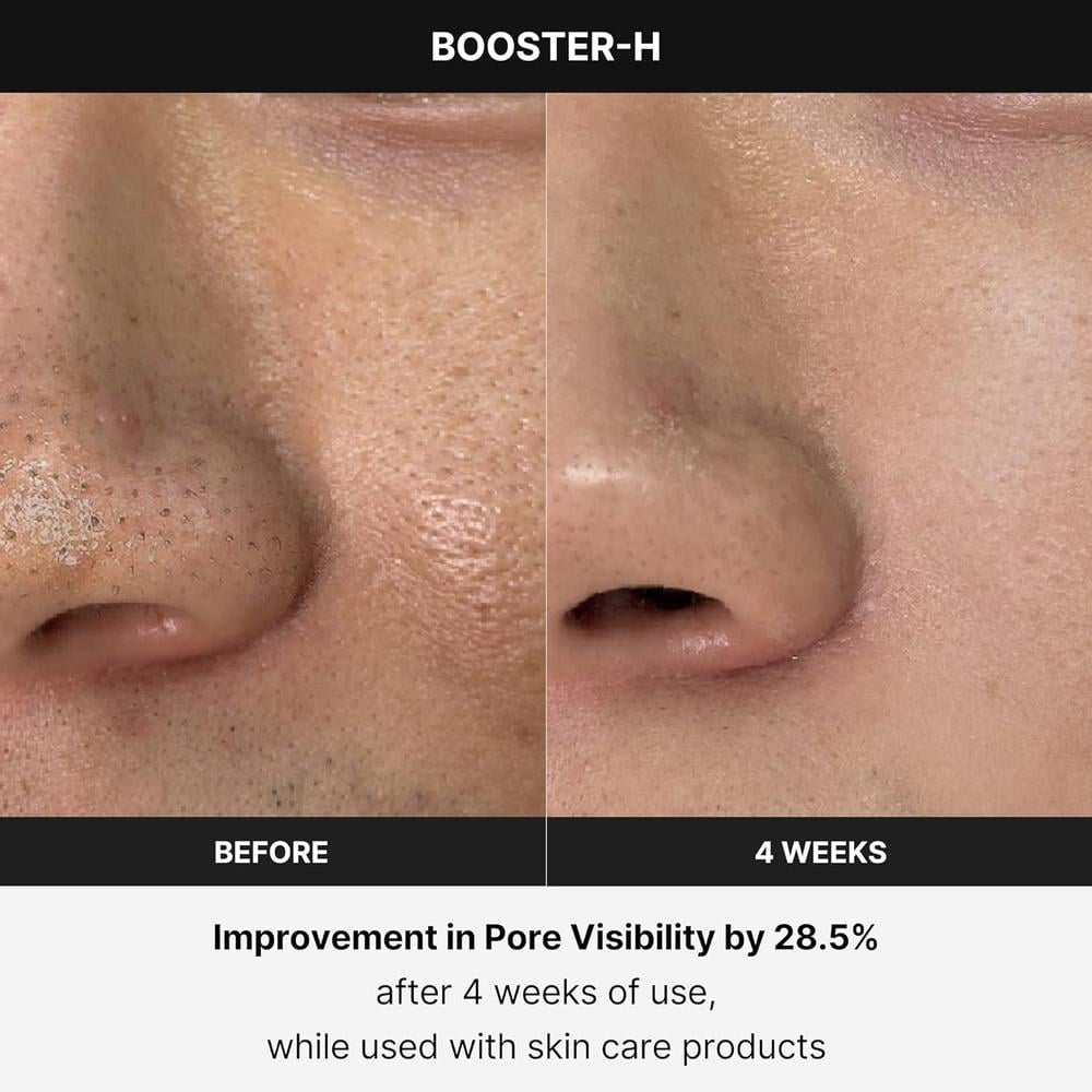 MEDICUBE BOOSTER H BEAUTY DEVICE - 5