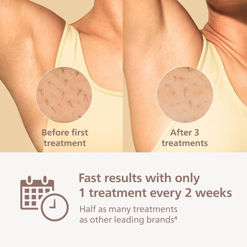 DEPILADORA IPL PHILIPS LUMEA SERIES 8000 BRI937/03 - 4