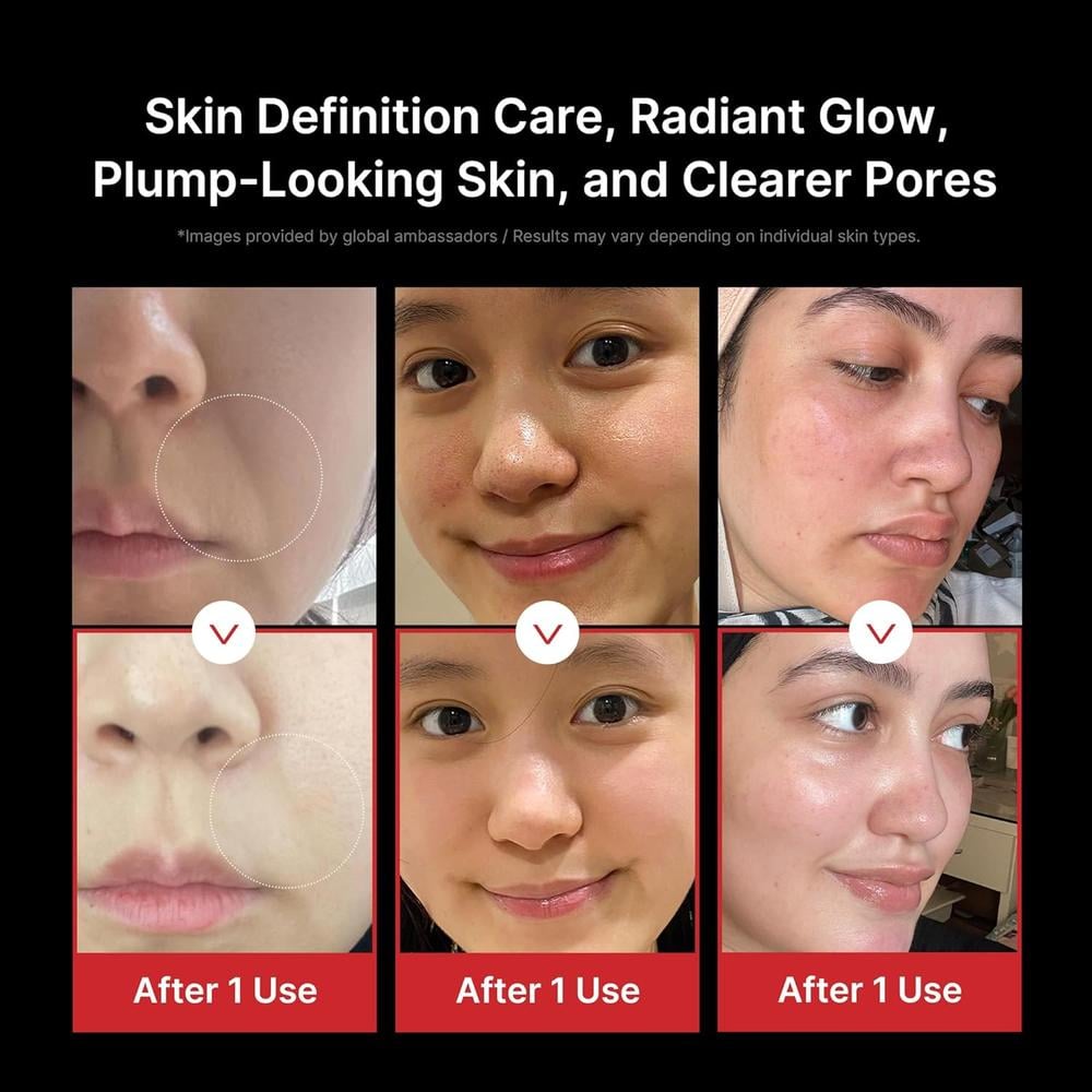 MASAJEADOR FACIAL MEDICUBE AGE-R BOOSTER PRO 6 EN 1 TECNOLOGÍA COREANA - 4