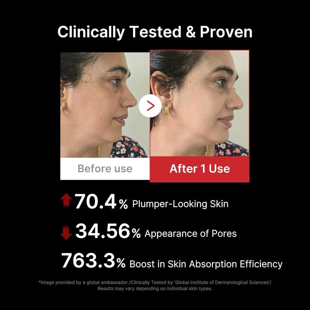 MASAJEADOR FACIAL MEDICUBE AGE-R BOOSTER PRO 6 EN 1 TECNOLOGÍA COREANA - 5