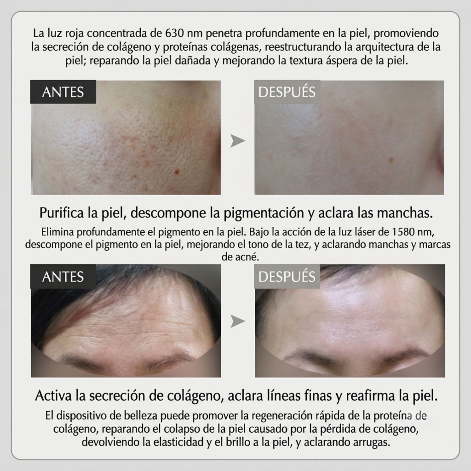 MÁSCARA LED FACIAL 7 EN 1 RECARGABLE CON GAFAS DE PROTECCIÓN DE REGALO - 4