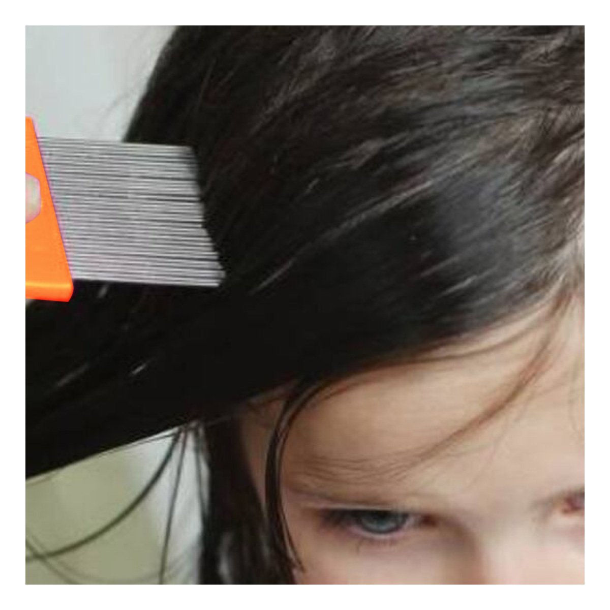 PACK2 HERRAMIENTA COMPACTA NARANJA PARA PIOJOS Y LIENDRES FACIL DE USAR Y+PAPEL REGALO - 2