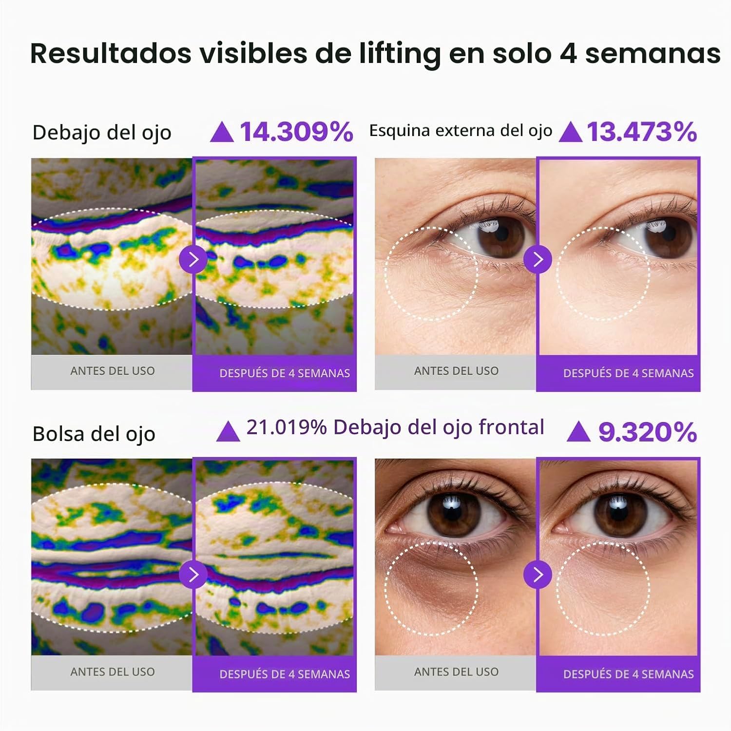 CENTELLIAN 24 360° SHOT PDRN LIFTING EYE CREAM 30ML CONTORNO DE OJOS - 4