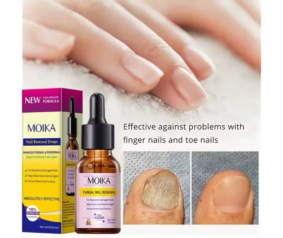 GEL PARA TRATAMIENTO DE UÑAS CON HONGOS. - 2