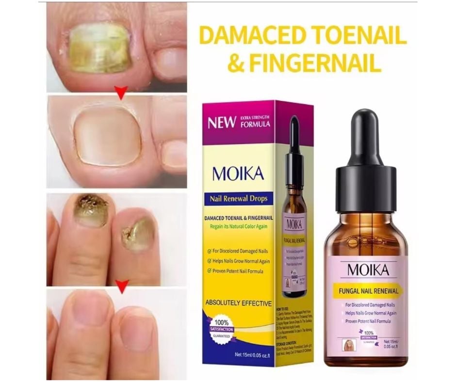 GEL PARA TRATAMIENTO DE UÑAS CON HONGOS. - 3