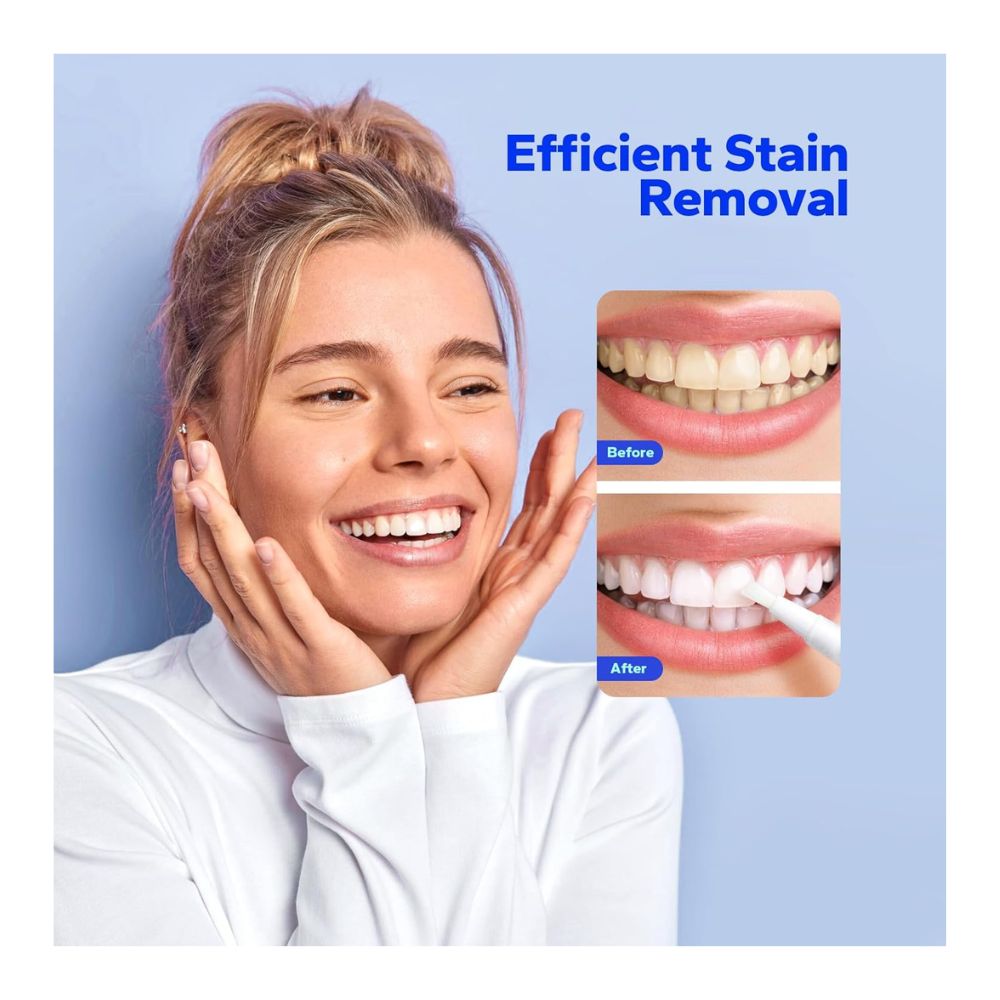BLANQUEADOR DENTAL SMILESHARK CON LUZ LED - 5