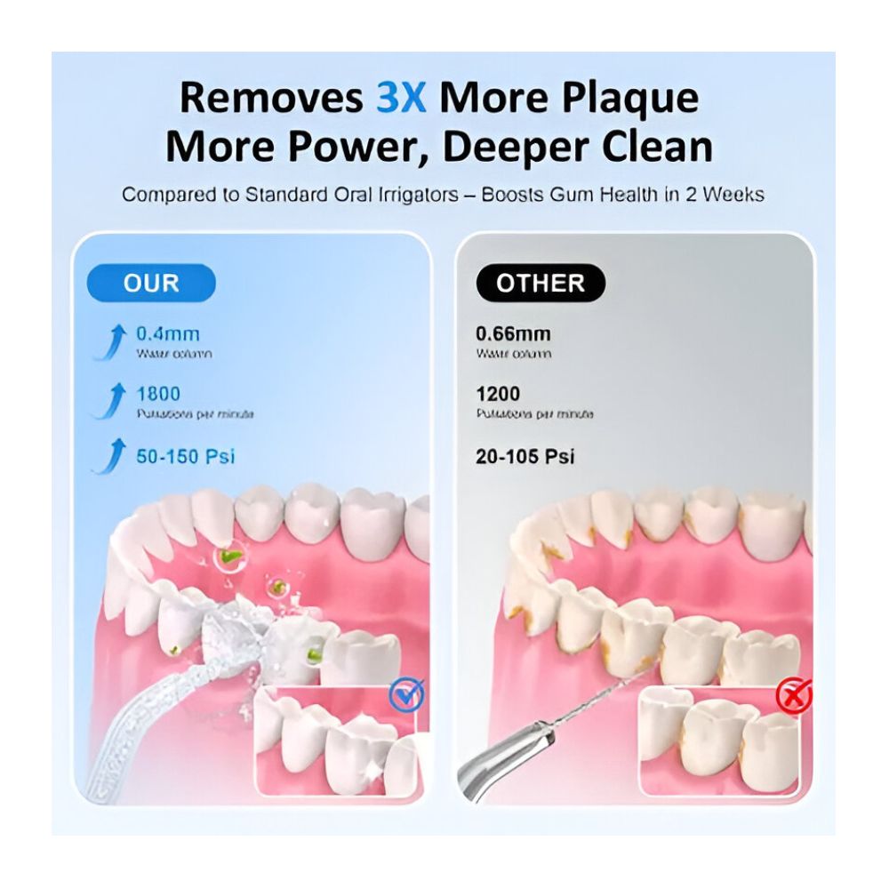 IRRIGADOR DENTAL ELÉCTRICO PORTÁTIL, 6 BOQUILLAS CARGA USB - 4