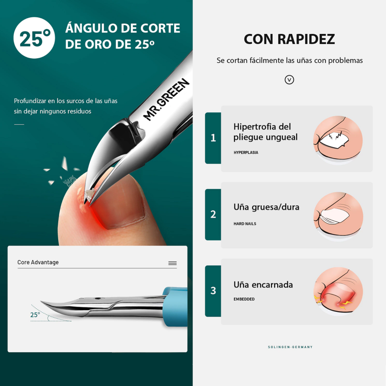 CORTAUÑAS UÑAS ENCARNADAS PEDICURA MR GREEN MR1033 ACERO INOXIDABLE ANTISALPICADURAS. - 2
