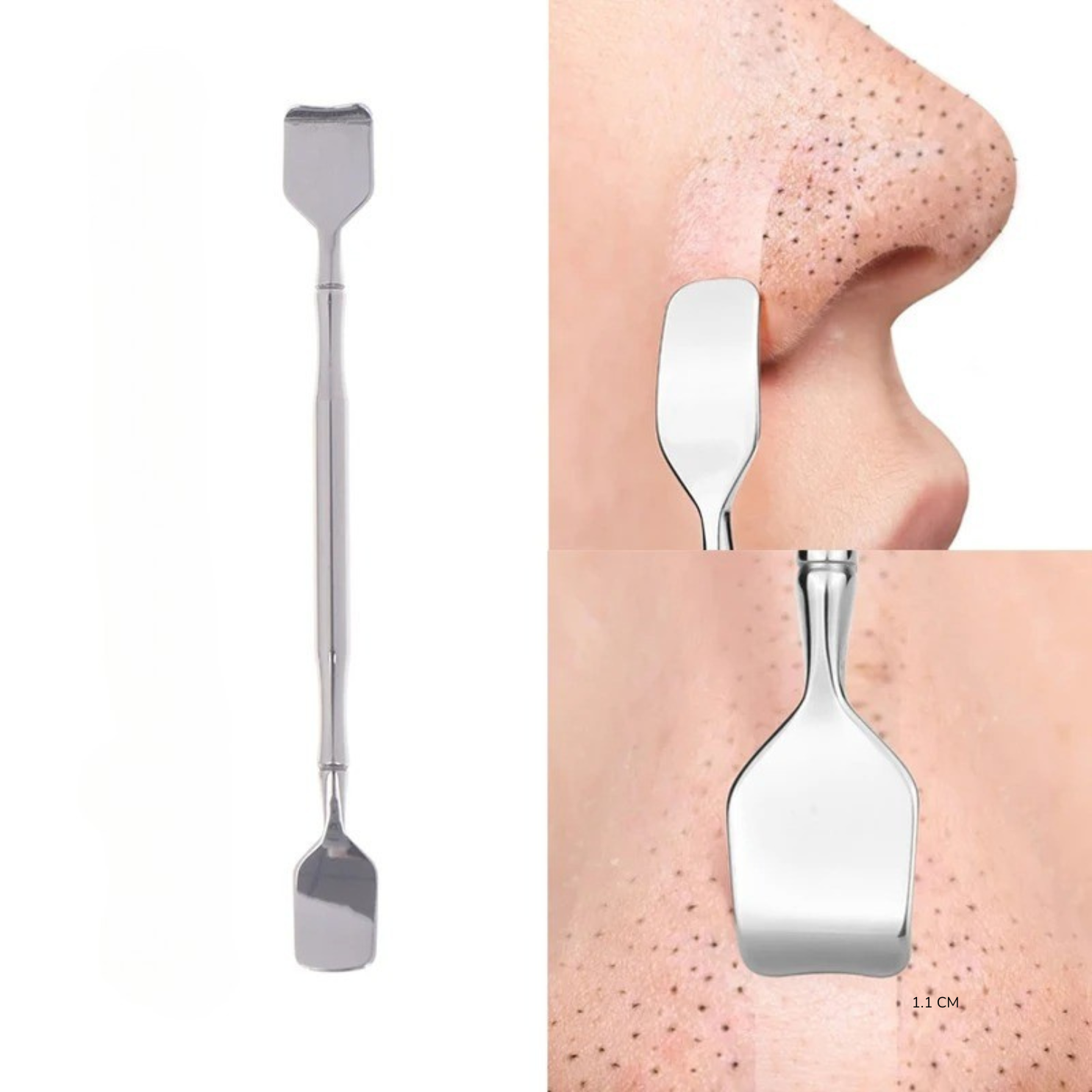 EXTRACTOR PUNTOS NEGROS REMOVEDOR ESPINILLAS ACNE SACA COMEDONES ACERO INOXIDABLE SET 5 PIEZAS - 3
