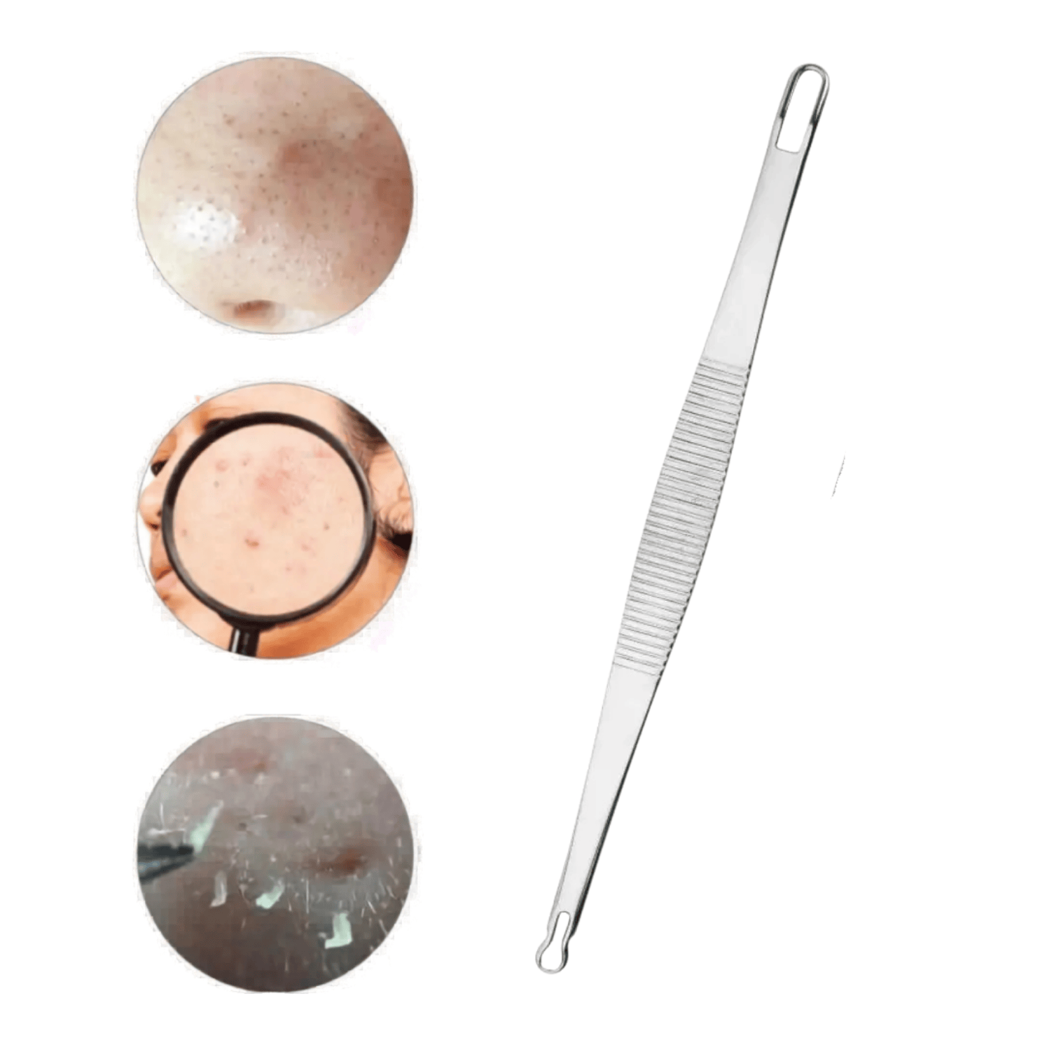 EXTRACTOR PUNTOS NEGROS REMOVEDOR ESPINILLAS ACNE SACA COMEDONES ACERO INOXIDABLE SET 5 PIEZAS - 4