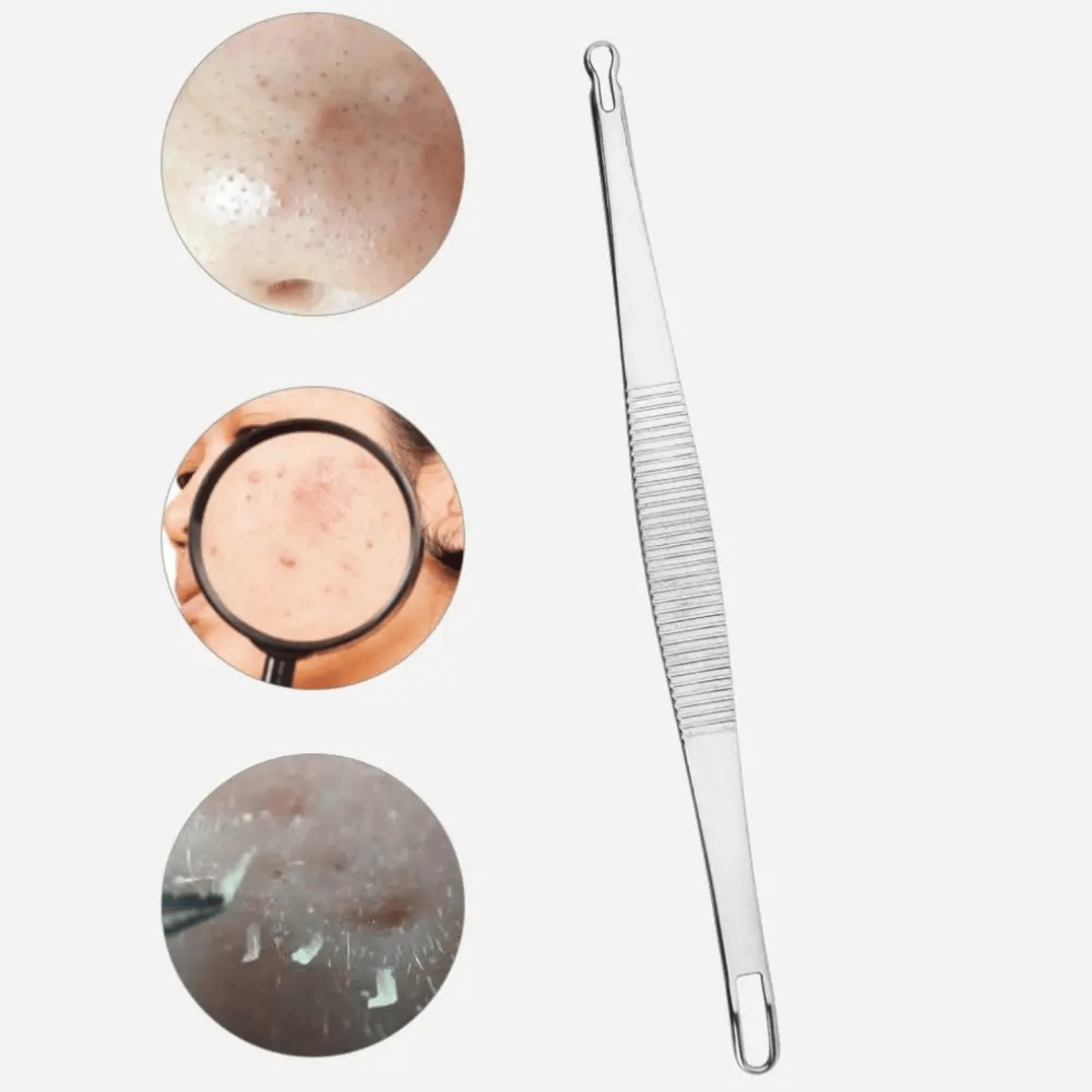 EXTRACTOR REMOVEDOR PUNTOS NEGROS ACNE SACA COMEDONES SM ACERO INOXIDABLE SET 9 PCS. - 9