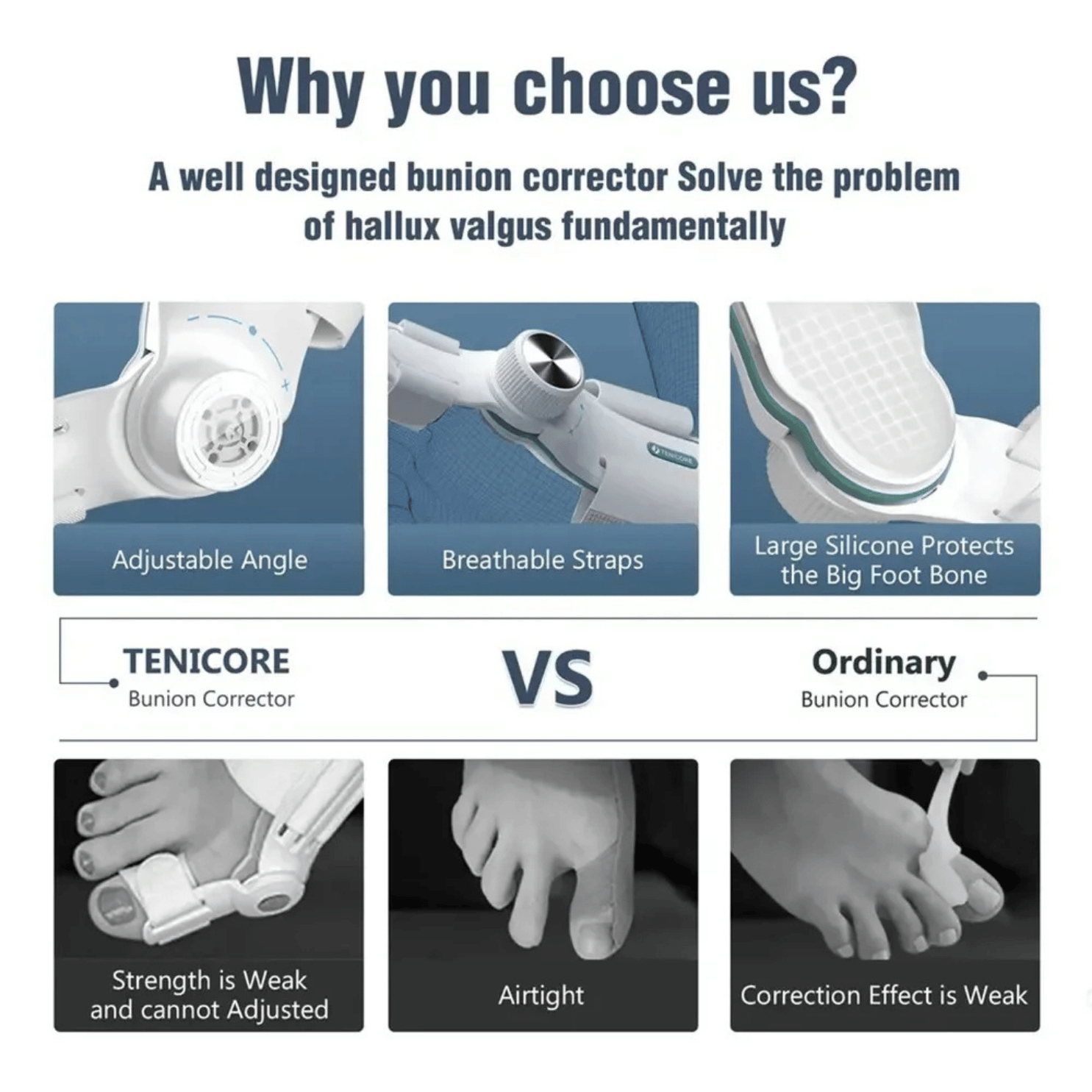 CORRECTOR JUANETE HALLUX VALGUS PLACAS FIJACIÓN 3 ÁNGULOS - 3