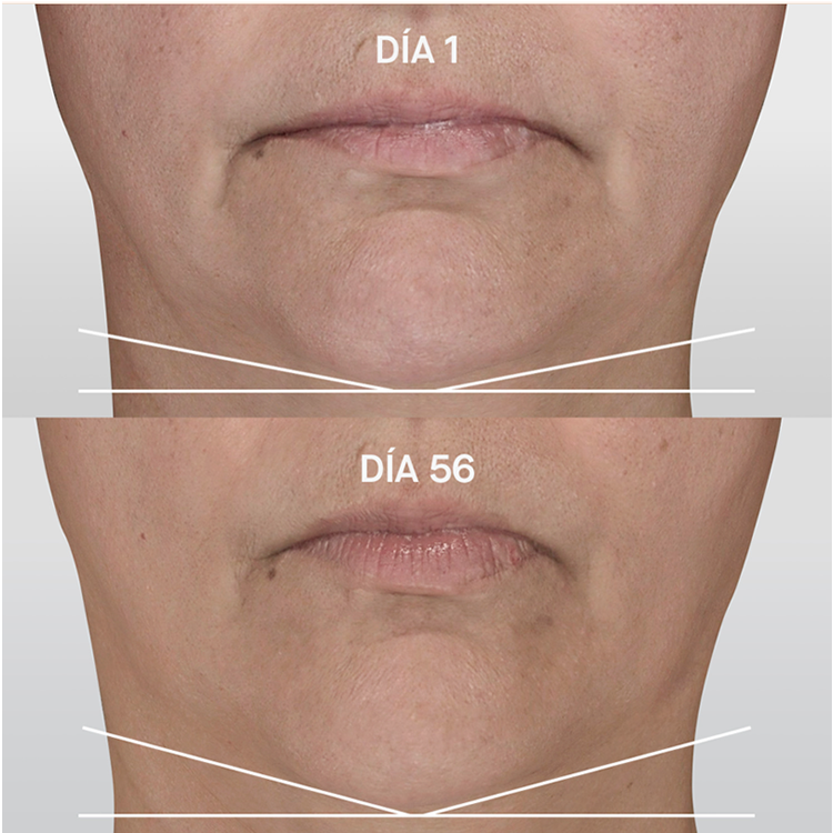 GENACTIVE SERUM REAFIRMANTE ANTIGRAVEDAD - 5