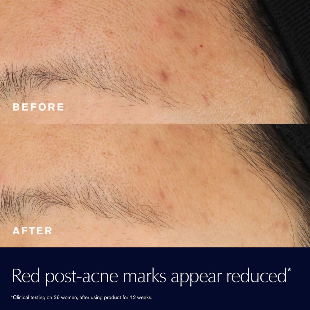 ESTÉE LAUDER ADVANCED NIGHT REPAIR – SUERO REPARADOR CON 15% FERMENTO BIFIDO - 4