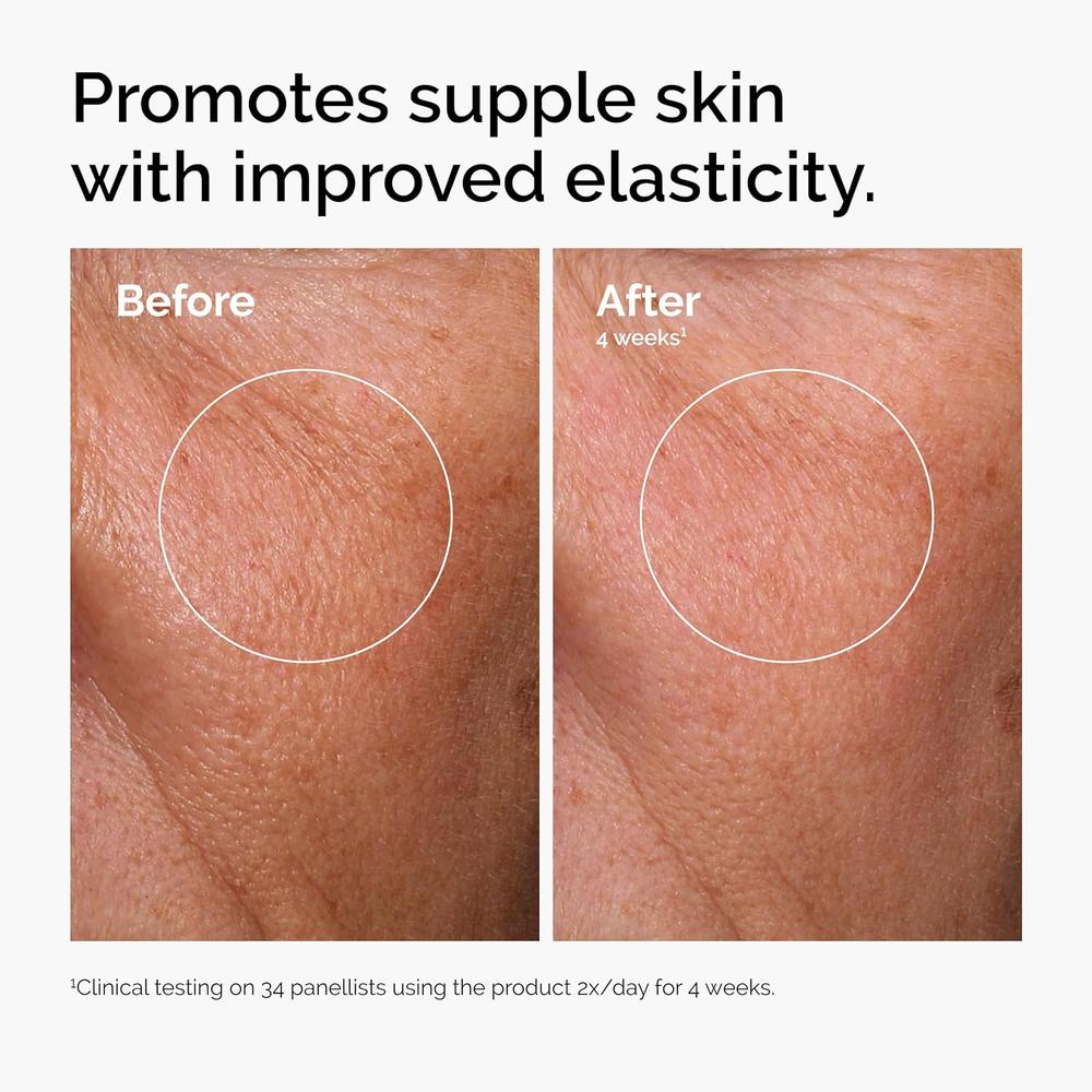 THE ORDINARY PEELING AHA 30% + BHA 2% Y SÉRUM ÁCIDO HIALURÓNICO 2% + B5 - 5