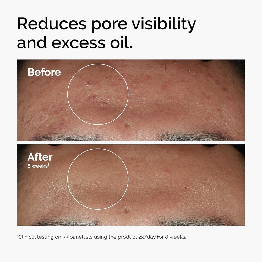 THE ORDINARY SÉRUM NIACINAMIDE 10% + ZINC 1% PIEL CON IMPERFECCIONES | 30 ML. - 2