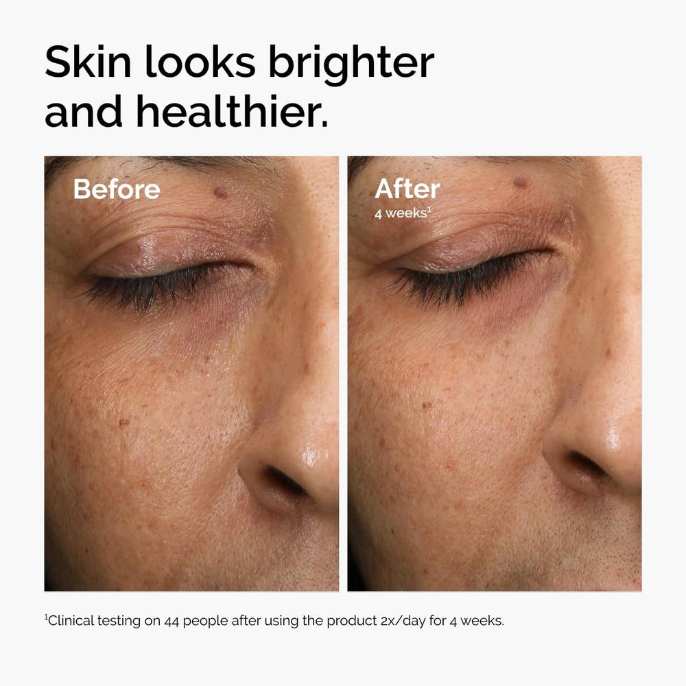THE ORDINARY SÉRUM RADIANTE ANTIOXIDANTE CON VITAMINA C ILUMINADOR | 30 ML. - 4