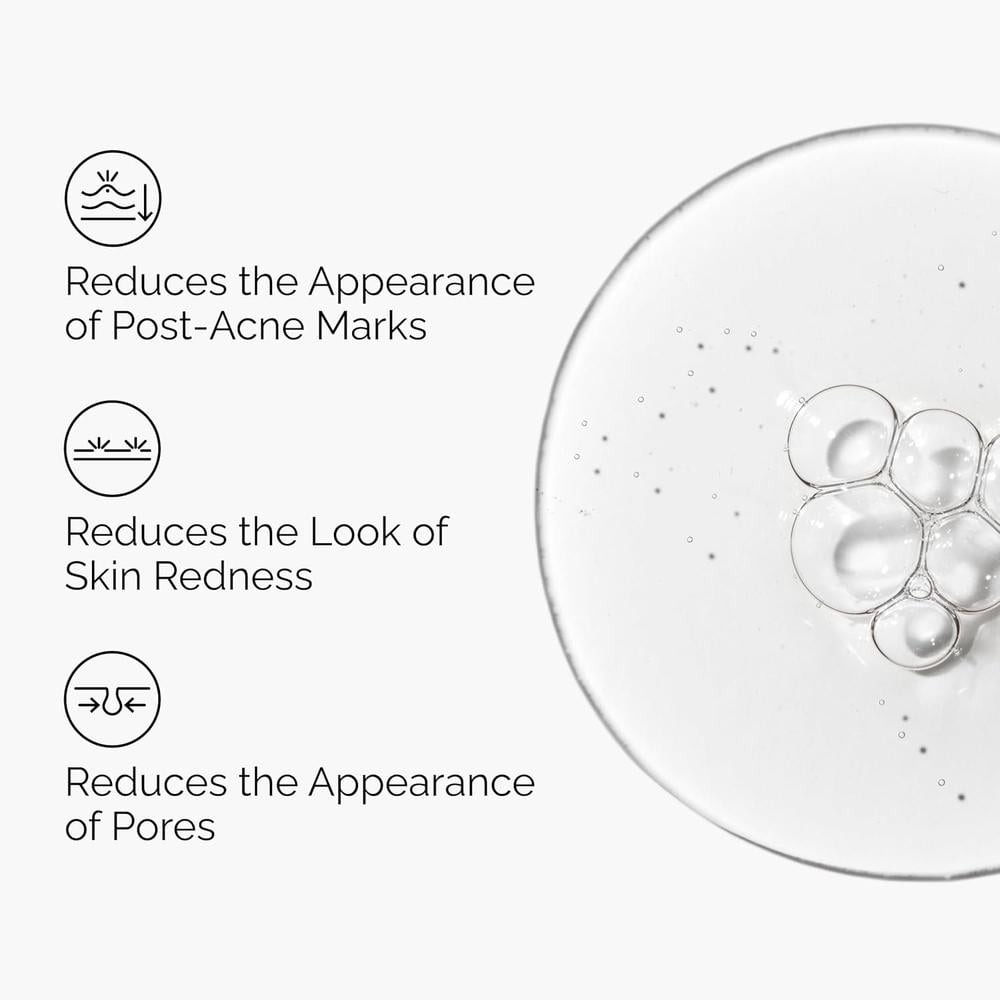 THE ORDINARY SOLUCIÓN ALOE 2% + NAG 2% CALMANTE Y REPARADORA POST-ACNÉ | 30 ML. - 3
